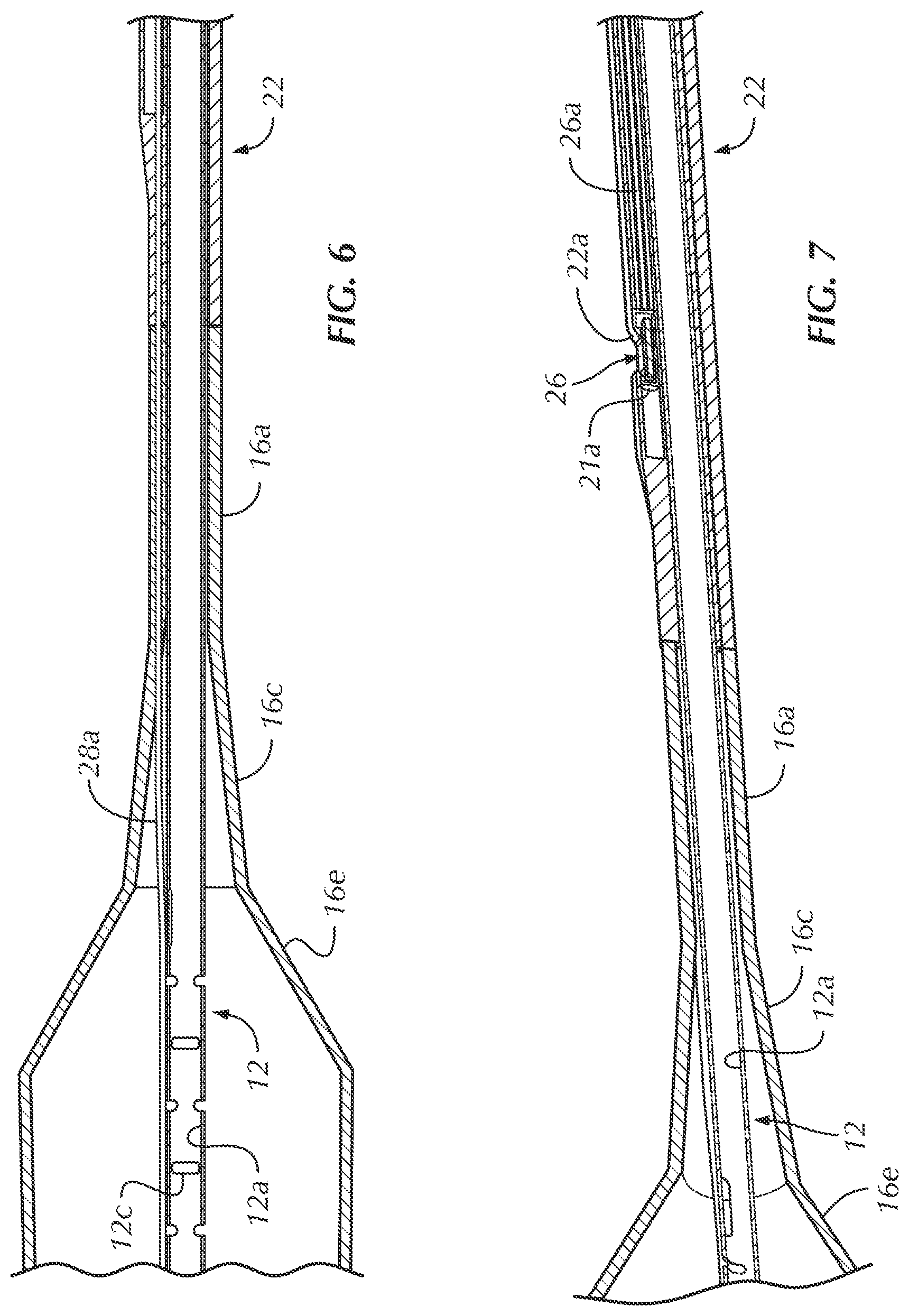 Patent US12102330 Figure 5 – Vascular occlusion catheter for partial occlusion or full occlusion