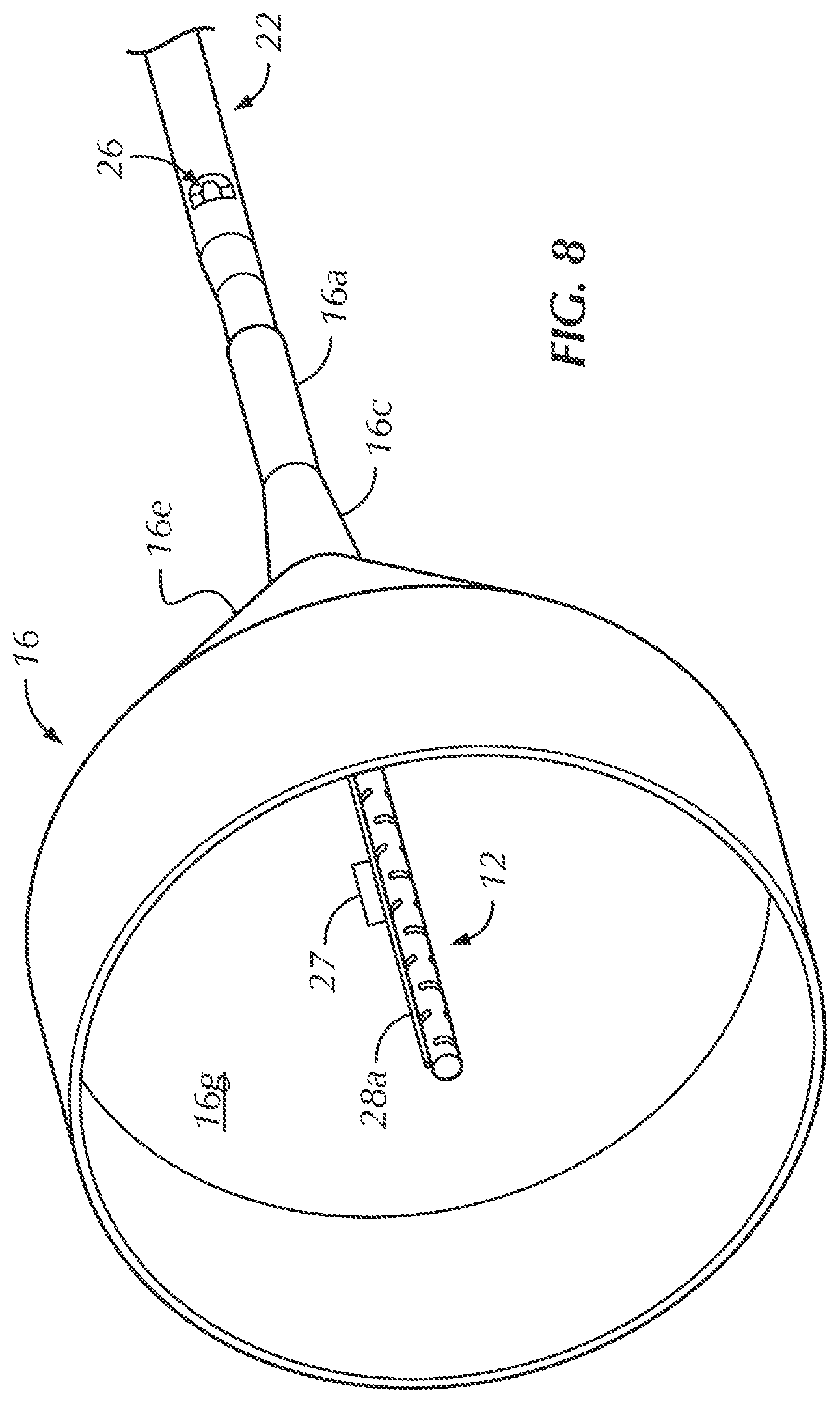 Patent US12102330 Figure 6 – Vascular occlusion catheter for partial occlusion or full occlusion