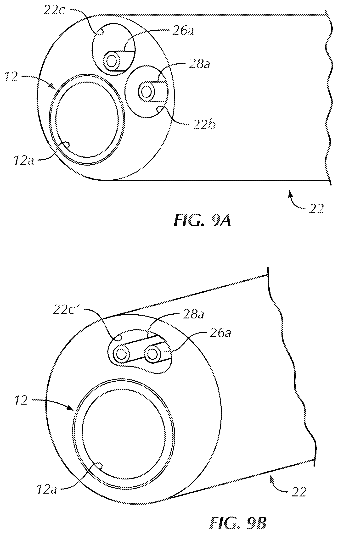 Patent US12102330 Figure 7 – Vascular occlusion catheter for partial occlusion or full occlusion
