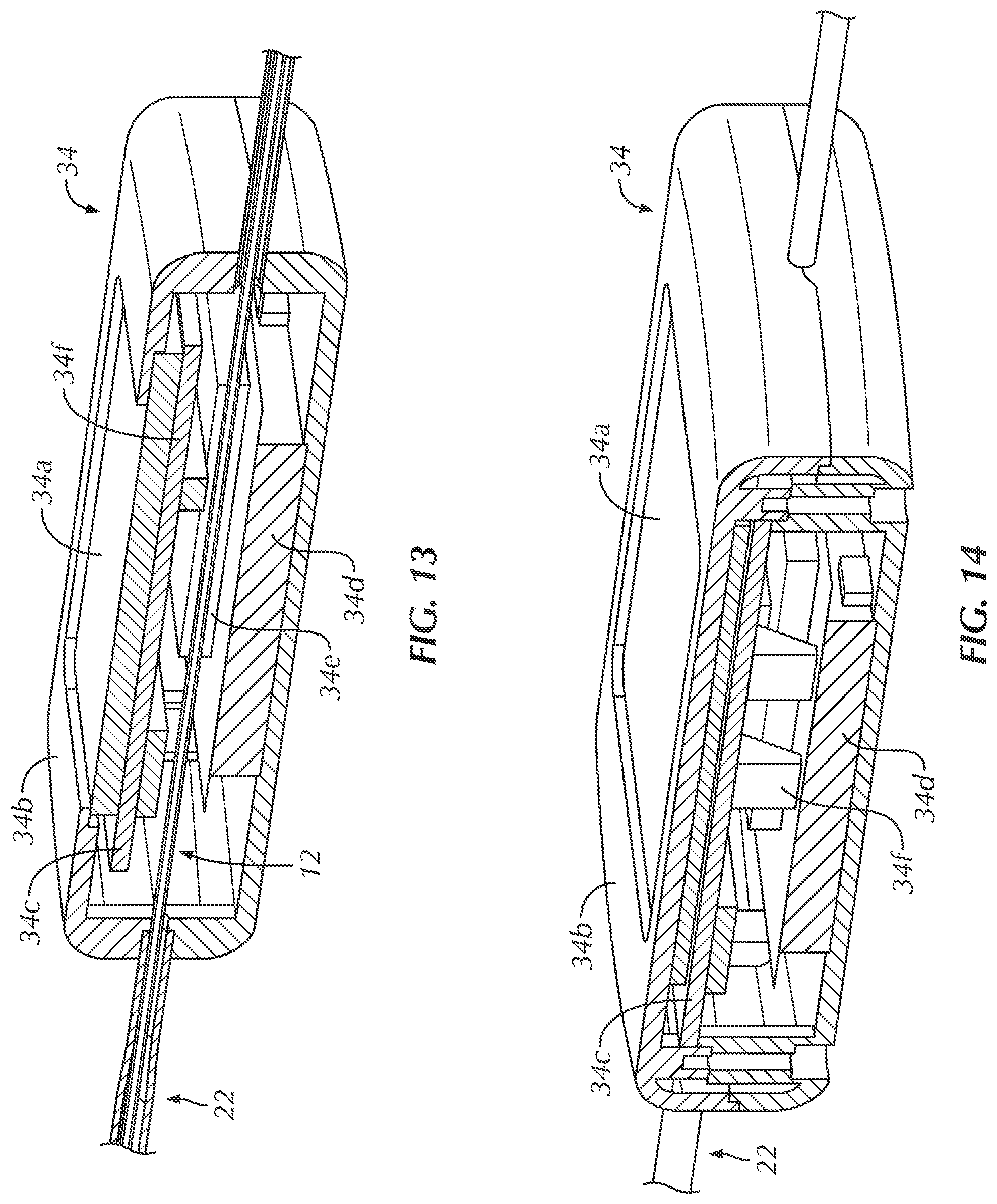 Patent US12102330 Figure 10 – Vascular occlusion catheter for partial occlusion or full occlusion