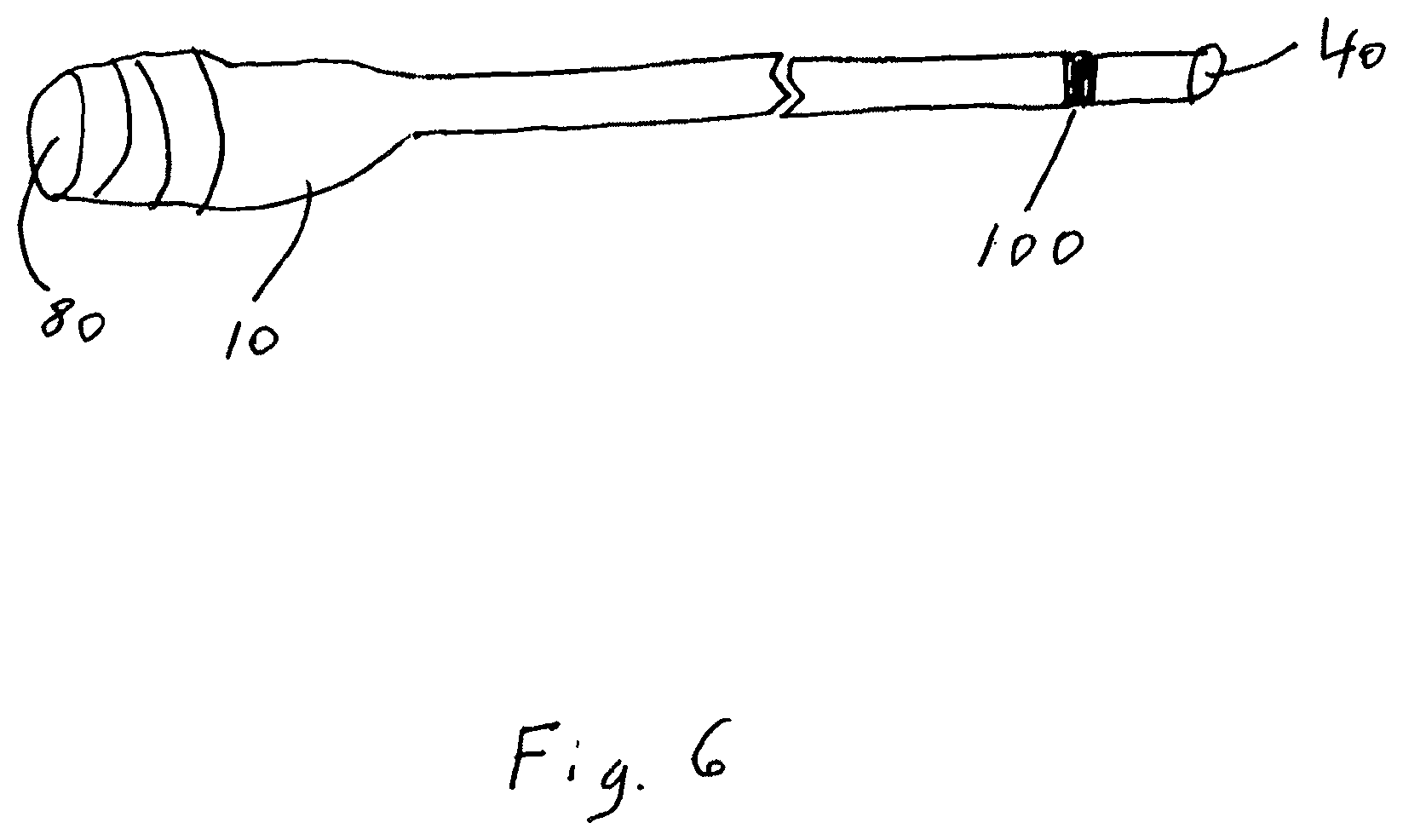 Patent US12102331 Figure 6 – Single lumen microcatheter for executing plugs near distal terminus of lumen