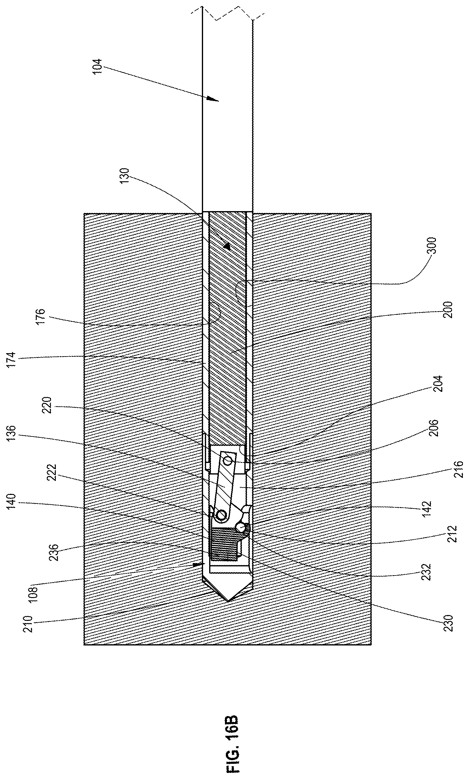 Patent US12102337 Figure 17 – Bone material removal device and a method for use thereof