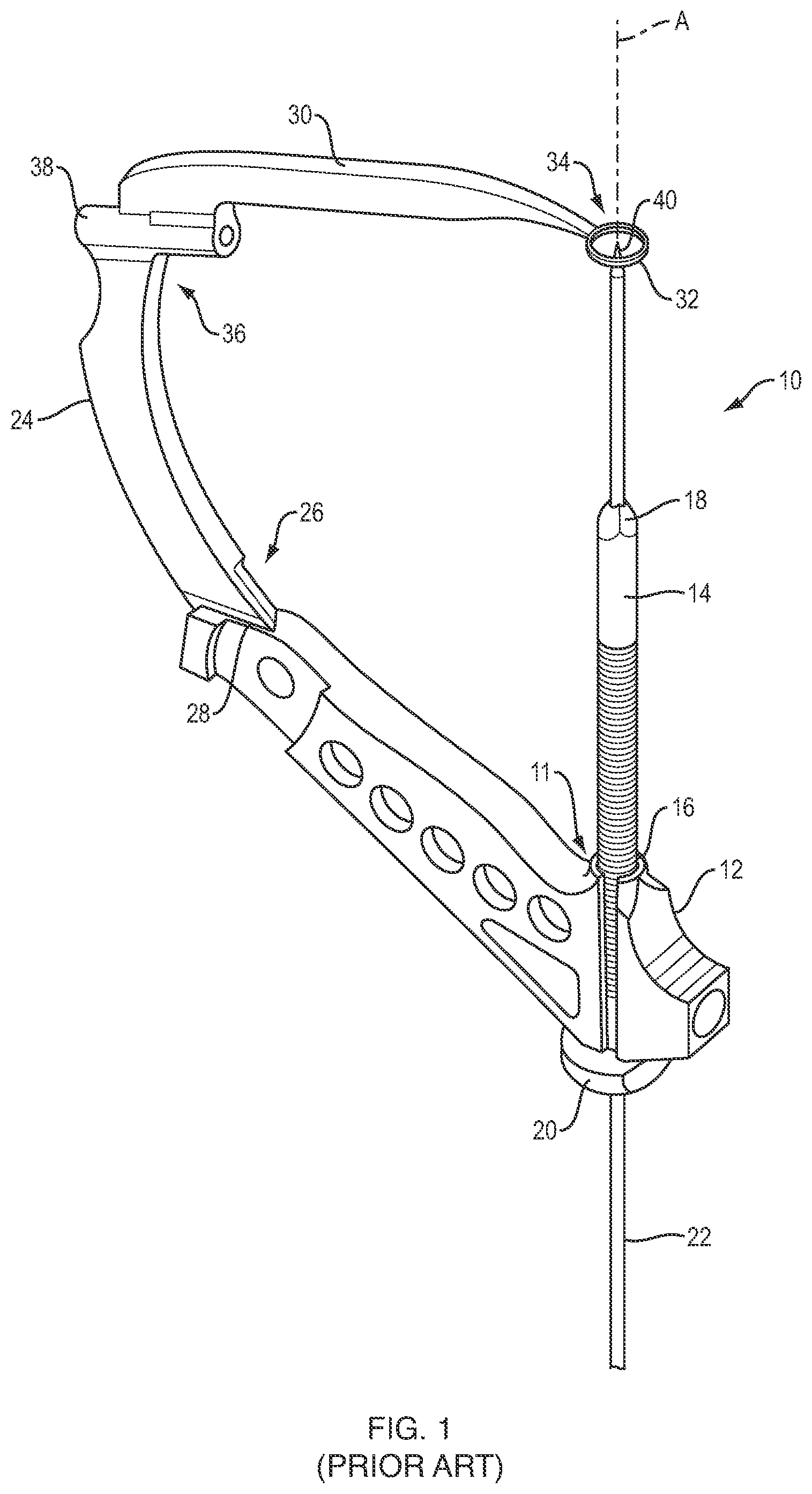Patent US12102340 Figure 1 – Surgical drill guide systems and methods of use thereof