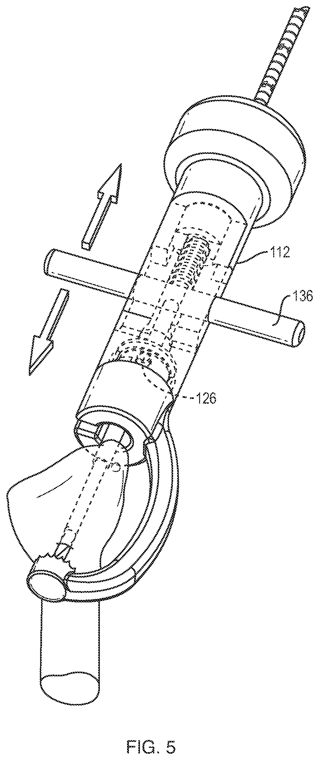 Patent US12102340 Figure 7 – Surgical drill guide systems and methods of use thereof