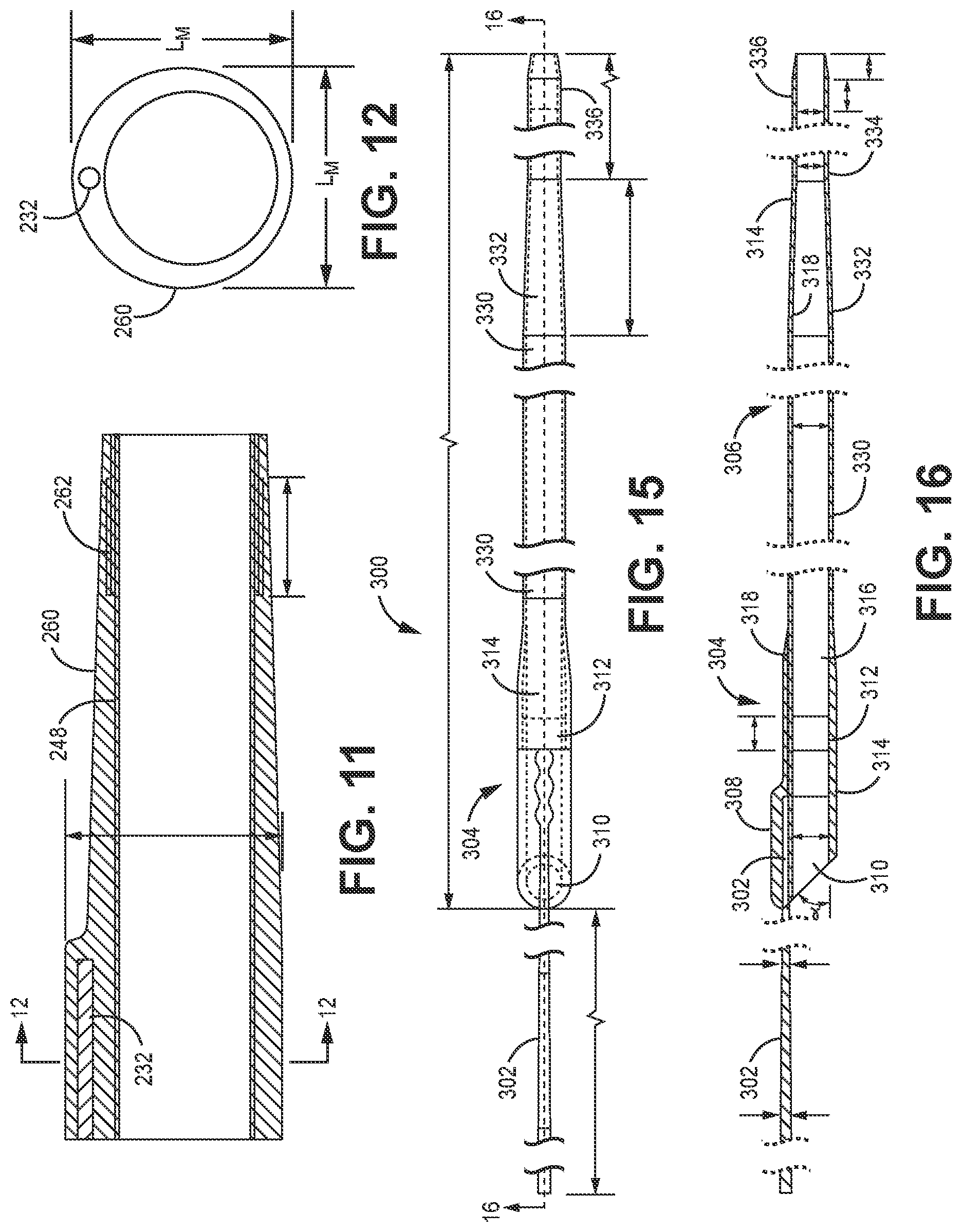 Patent US12102341 Figure 4 – Suction catheter systems for applying effective aspiration in remote vessels, especially cerebral arteries