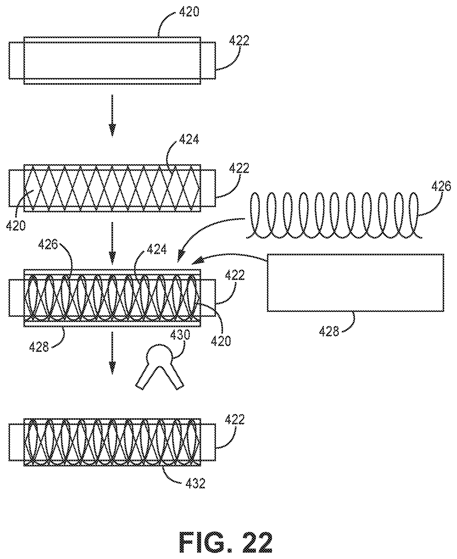 Patent US12102341 Figure 6 – Suction catheter systems for applying effective aspiration in remote vessels, especially cerebral arteries