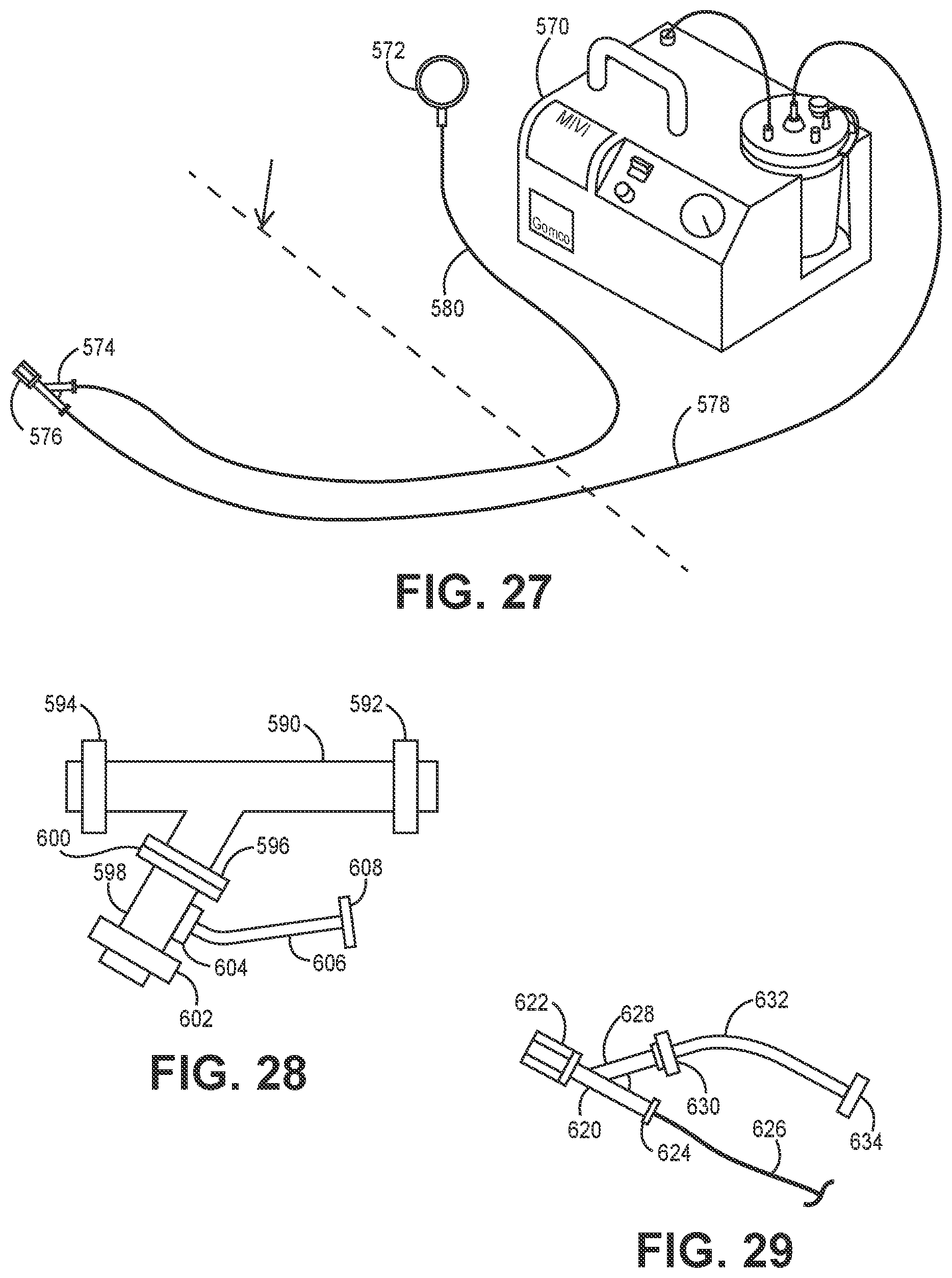 Patent US12102341 Figure 9 – Suction catheter systems for applying effective aspiration in remote vessels, especially cerebral arteries