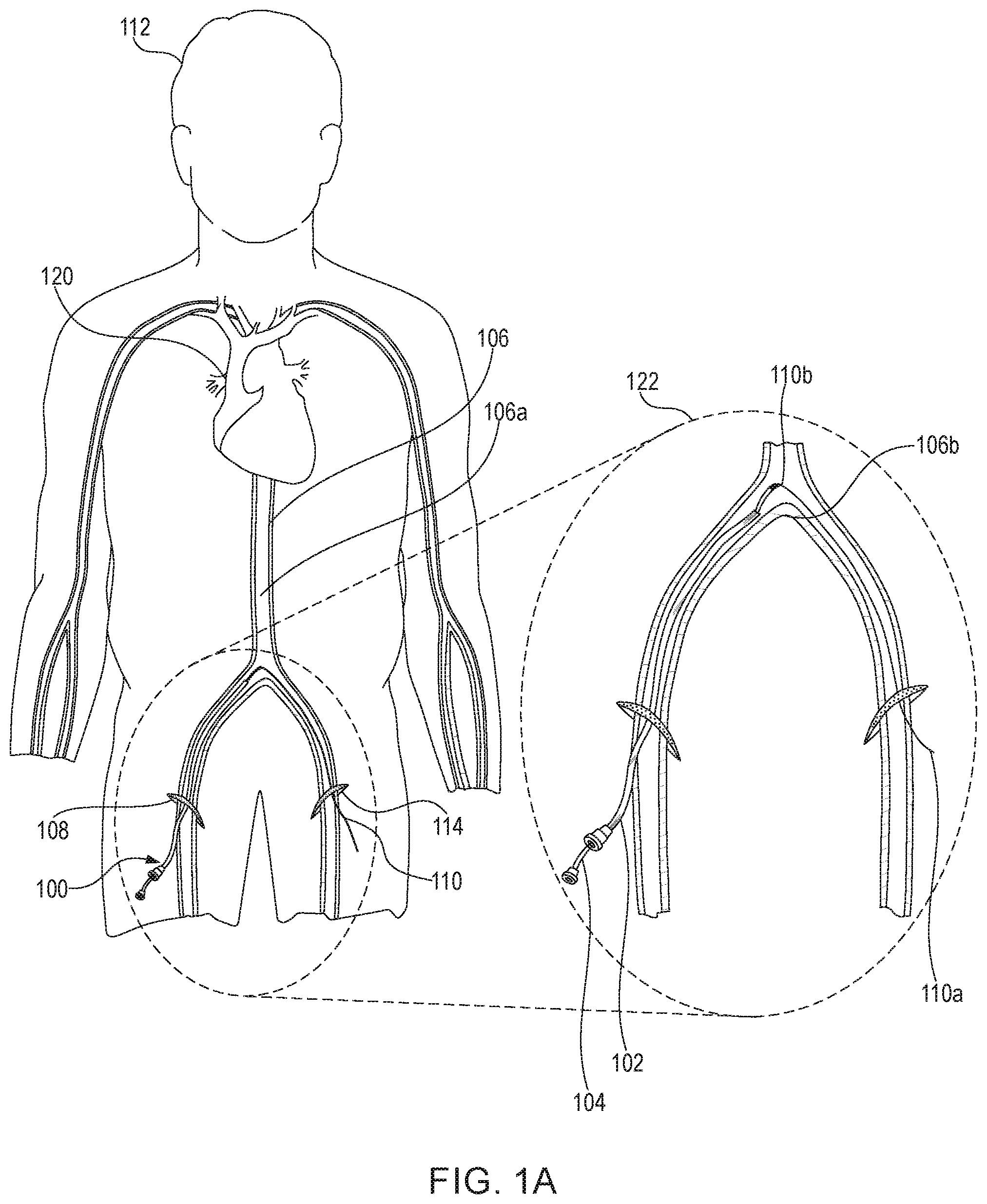 Patent US12102344 Figure 1 – Medical device for snaring guidewire