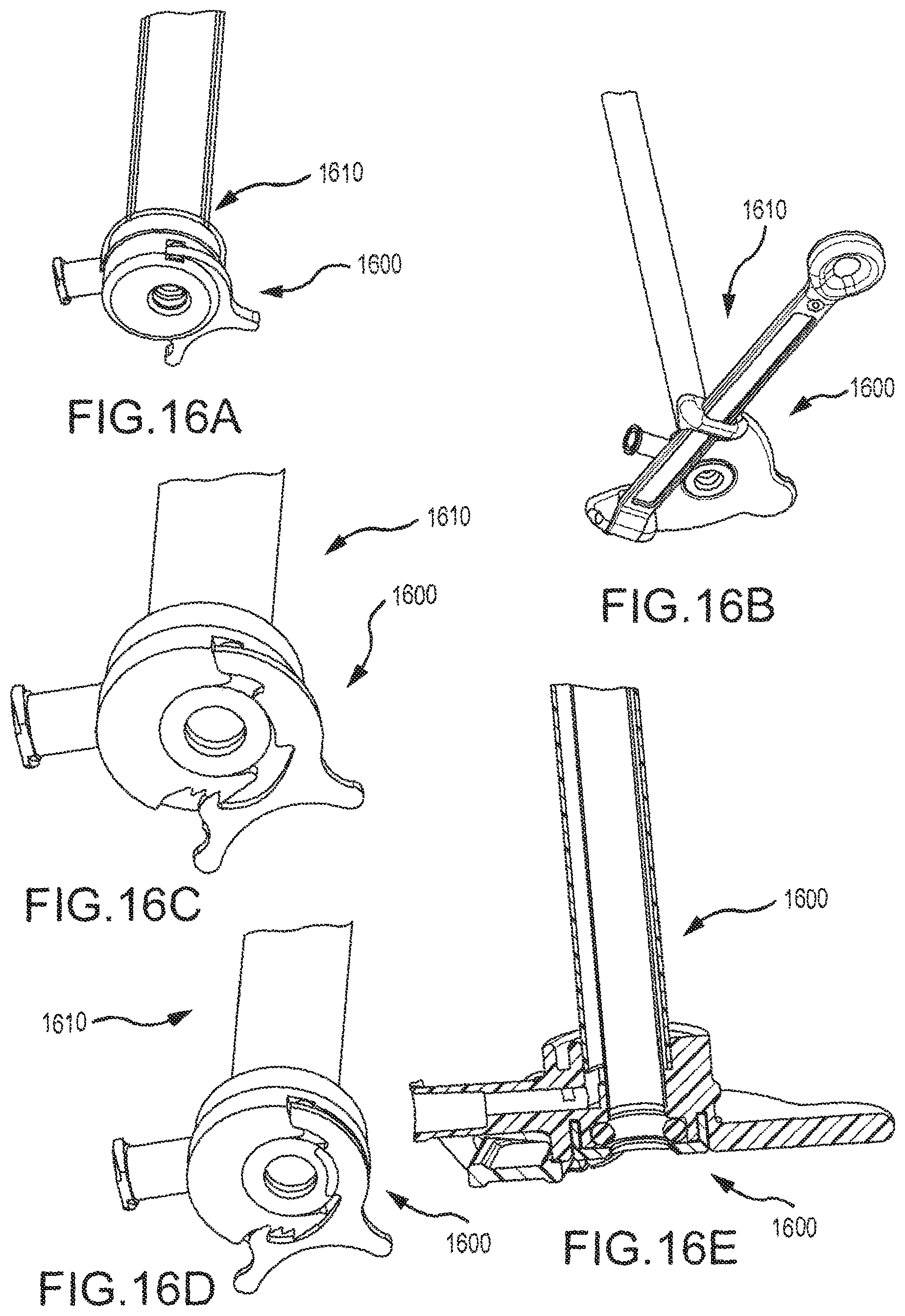 Patent US12102350 Figure 17 – Scope and magnetic introducer systems and methods