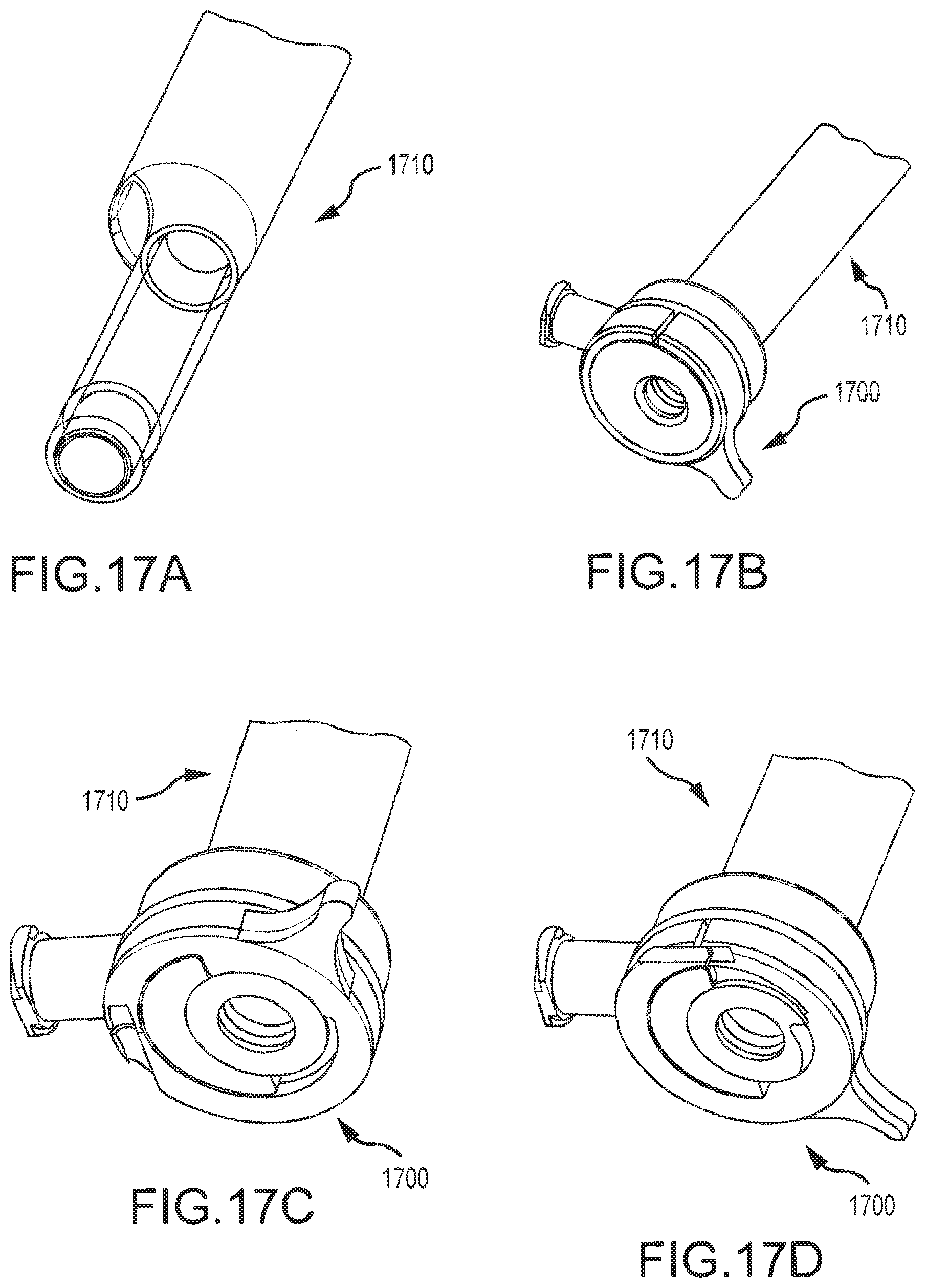 Patent US12102350 Figure 18 – Scope and magnetic introducer systems and methods