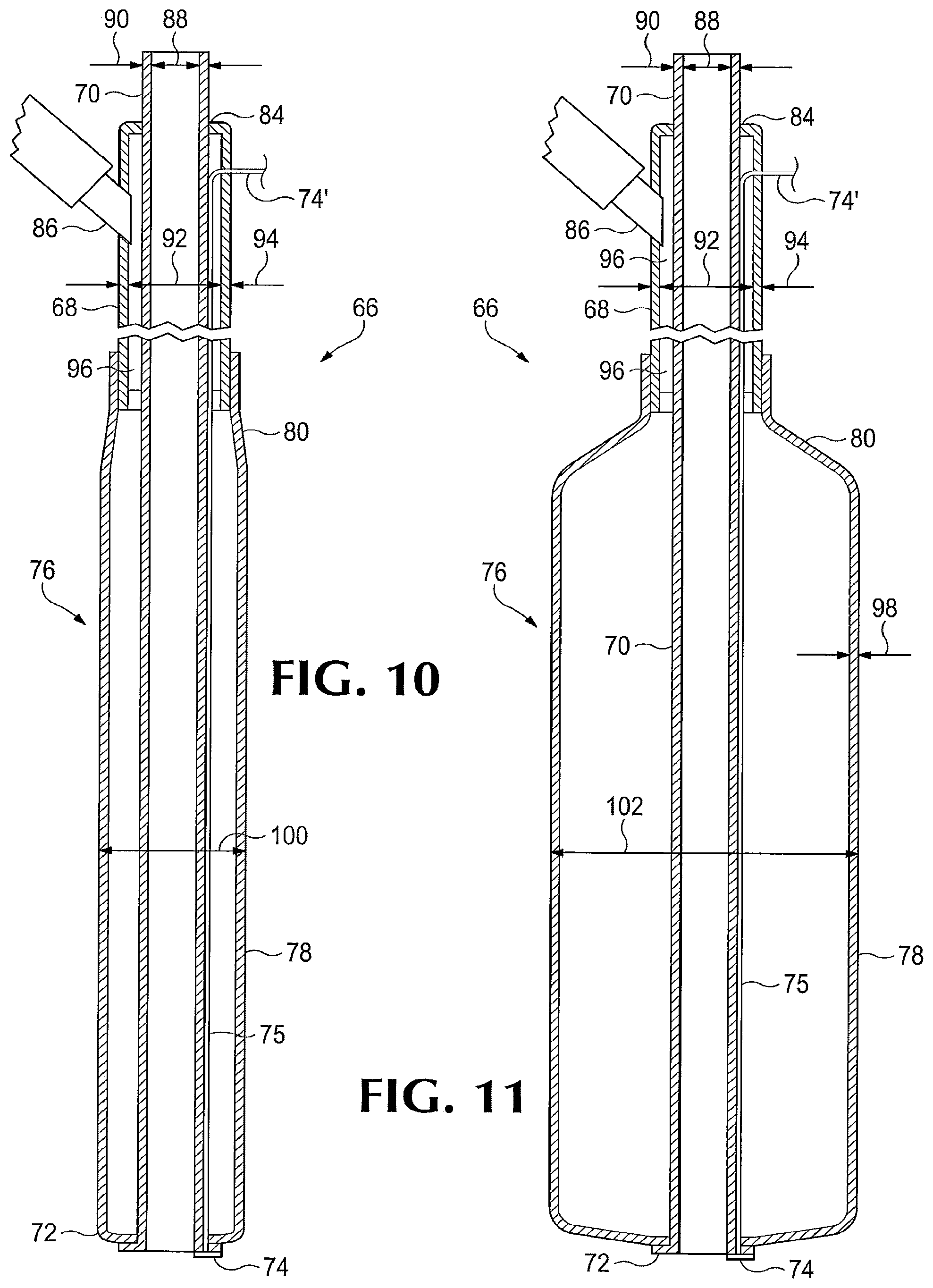 Patent US12102351 Figure 6 – Surgical probe incorporating a dilator
