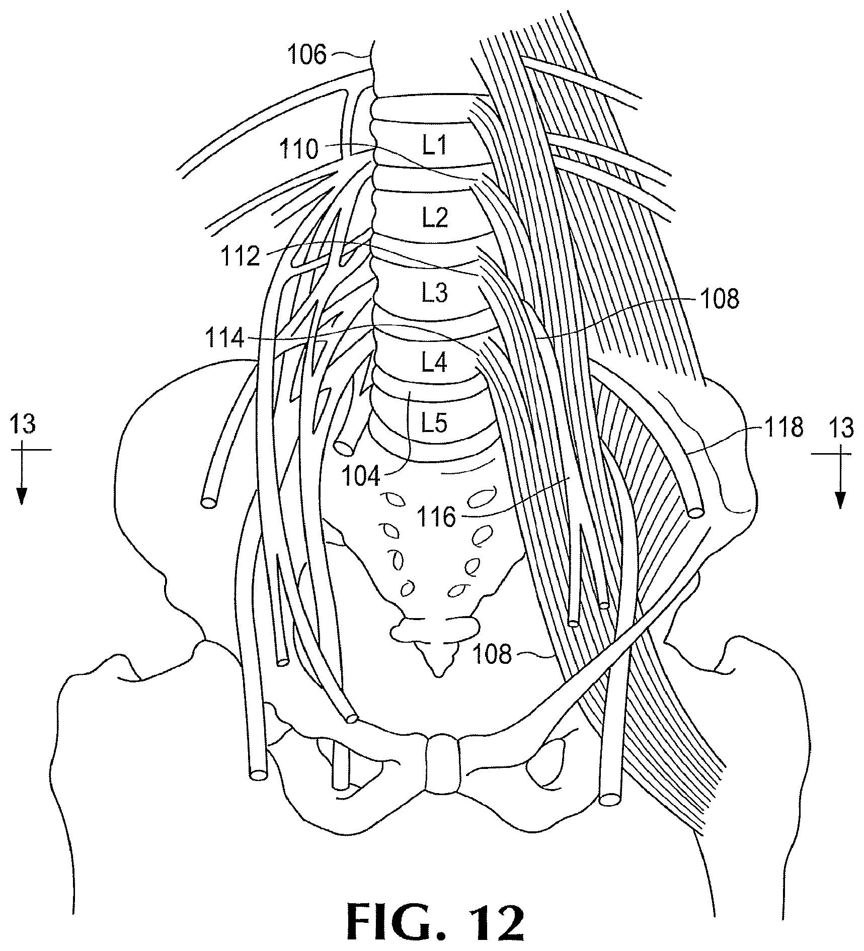 Patent US12102351 Figure 7 – Surgical probe incorporating a dilator