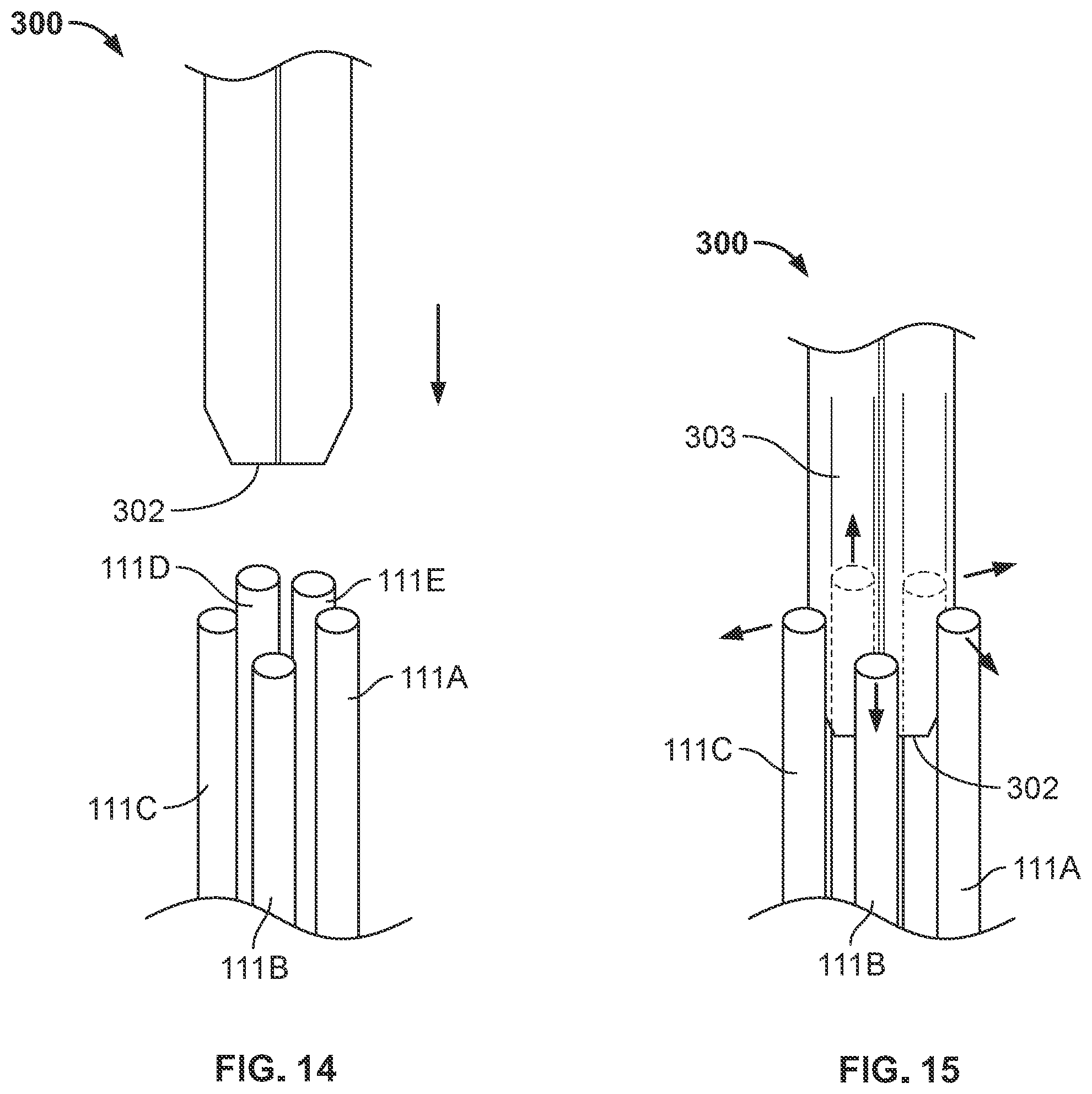 Patent US12102353 Figure 5 – Expanders for rod retraction