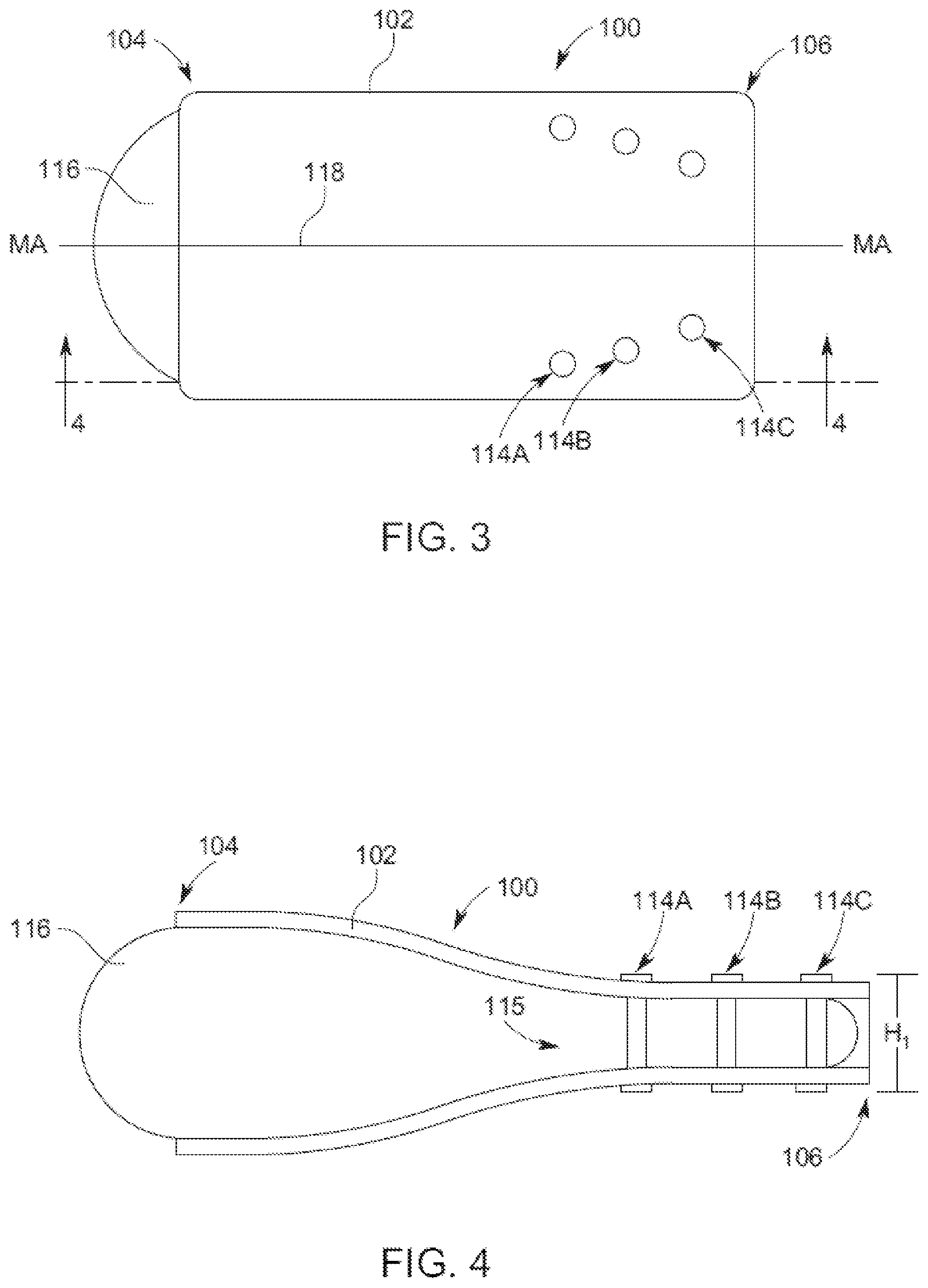 Patent US12102354 Figure 3 – Implant delivery sleeves having non-tapered tubular walls with constricted implant delivery channels for inserting implants into tissue pockets
