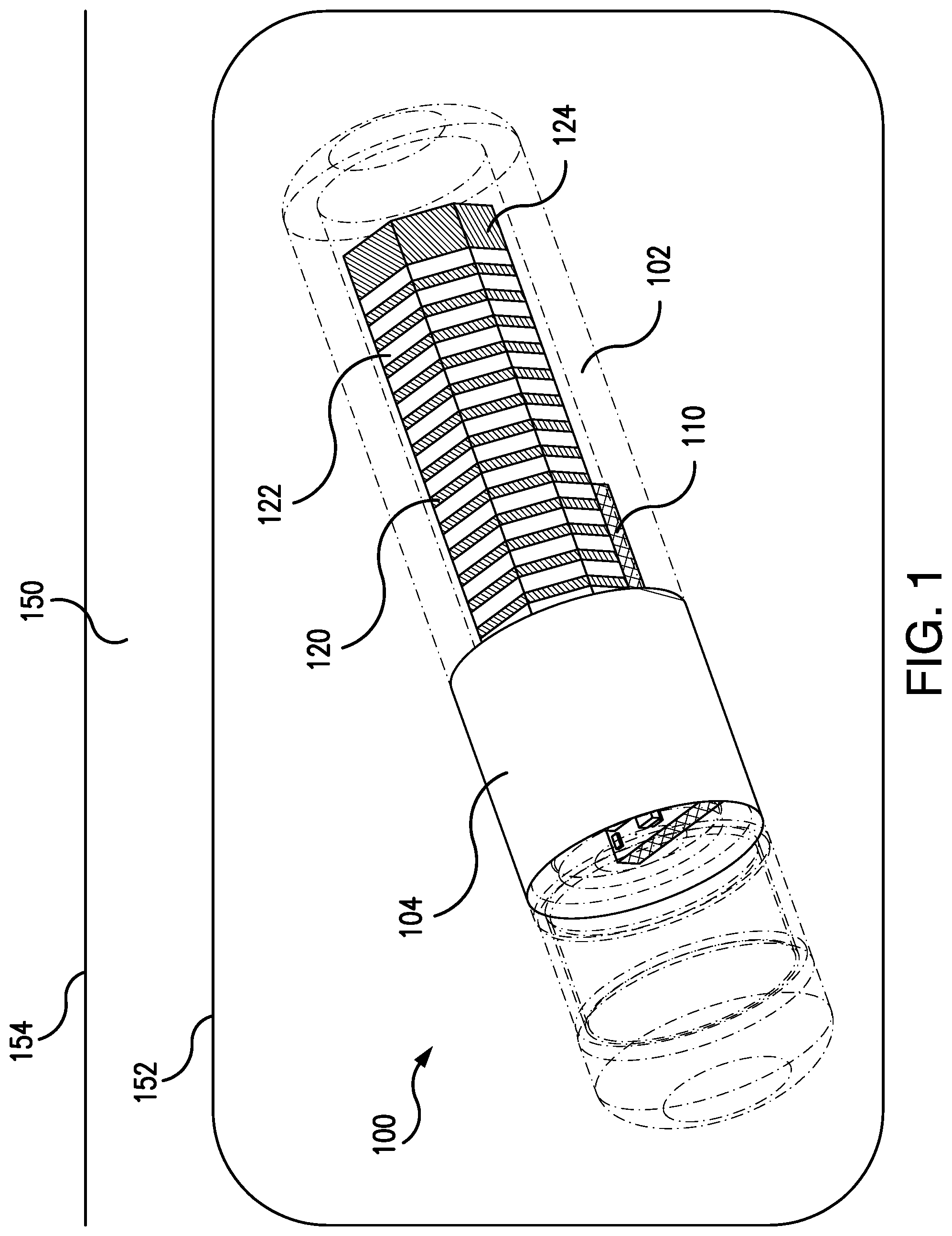 Patent US12102356 Figure 1 – Removal tool for a subcutaneous implantable device