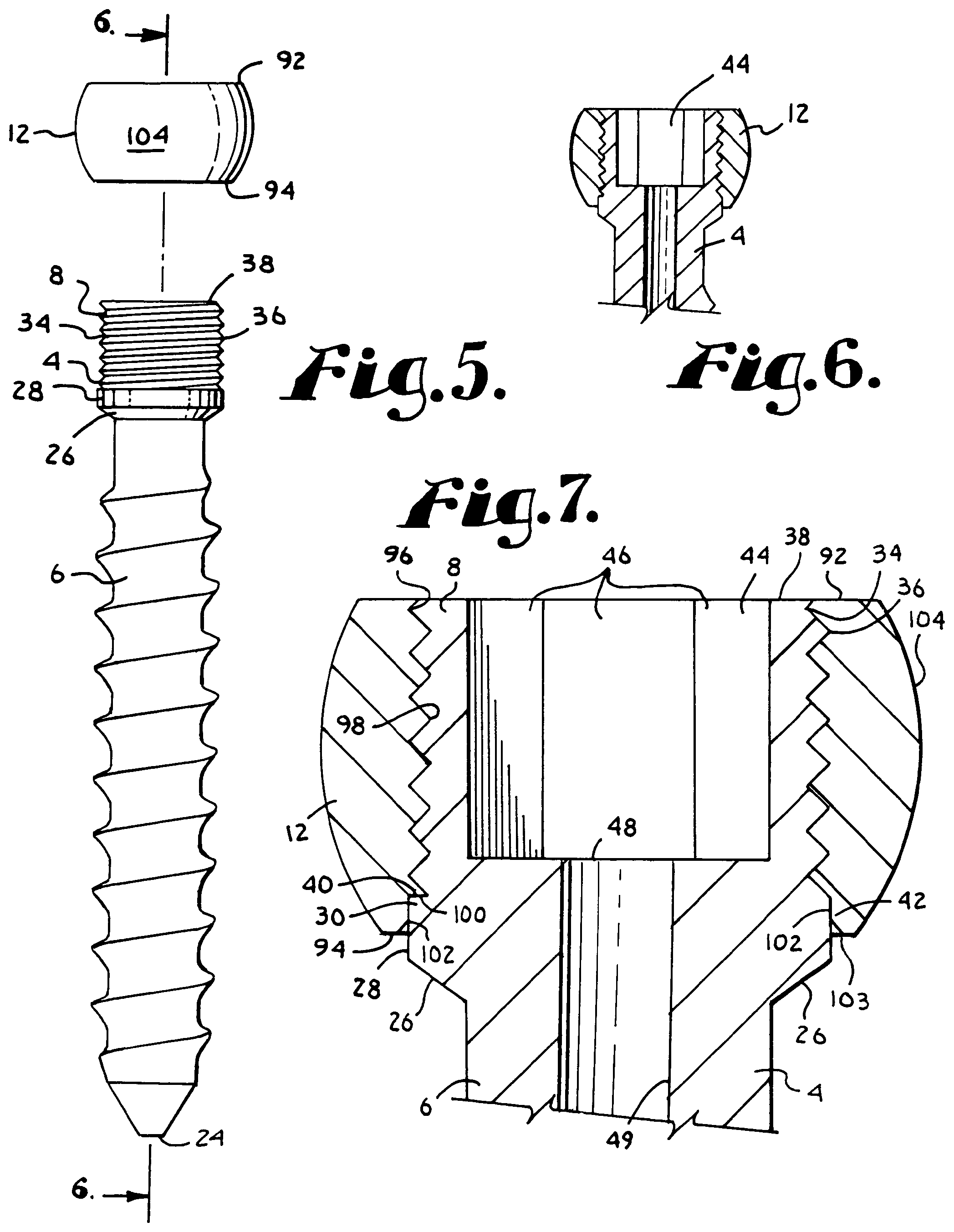 Patent US12102357 Figure 2 – Pivotal bone anchor assembly with cannulated shank having a planar top surface and method of assembly