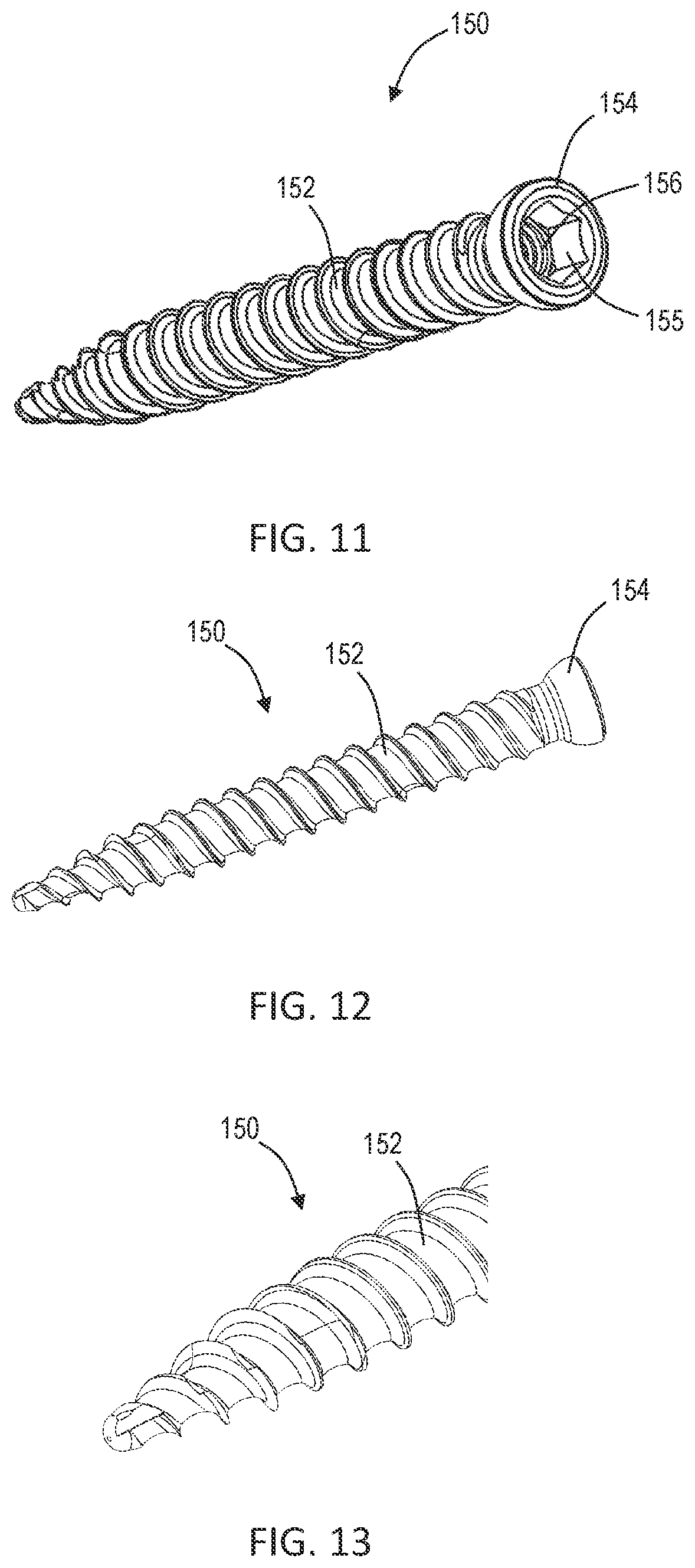 Patent US12102358 Figure 4 – Lateral vertebral lumbar plate system with integrated rotational control mechanism for screw retention