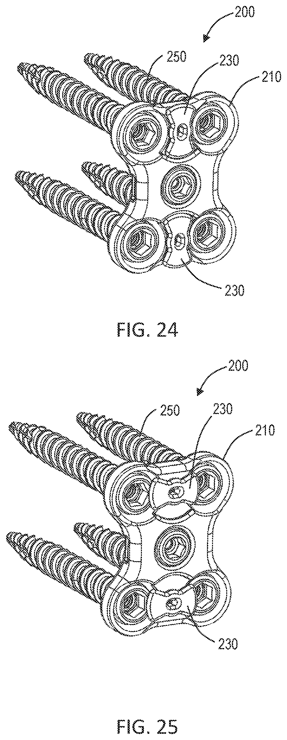 Patent US12102358 Figure 9 – Lateral vertebral lumbar plate system with integrated rotational control mechanism for screw retention