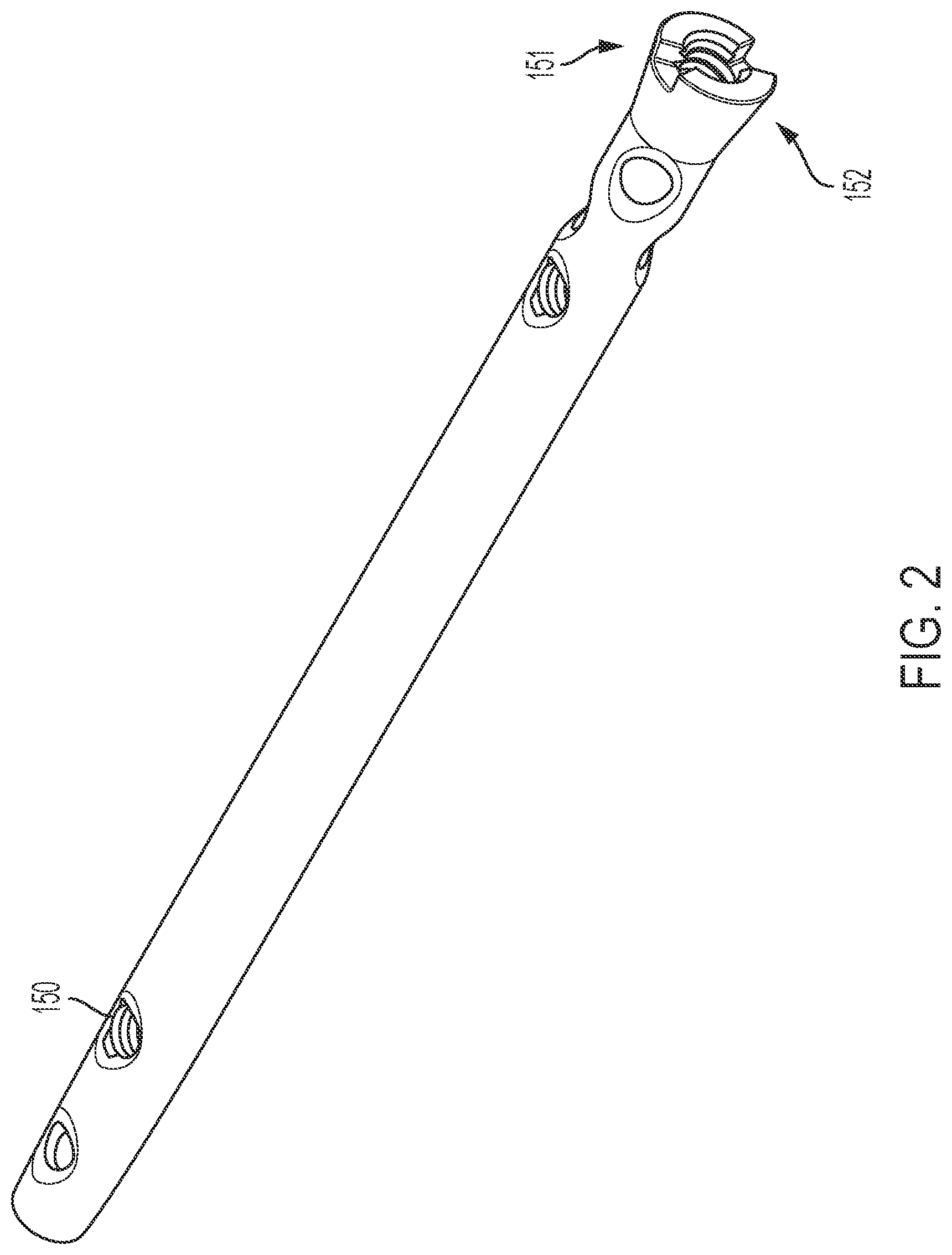 Patent US12102359 Figure 3 – Intramedullary fixation nail and method of use