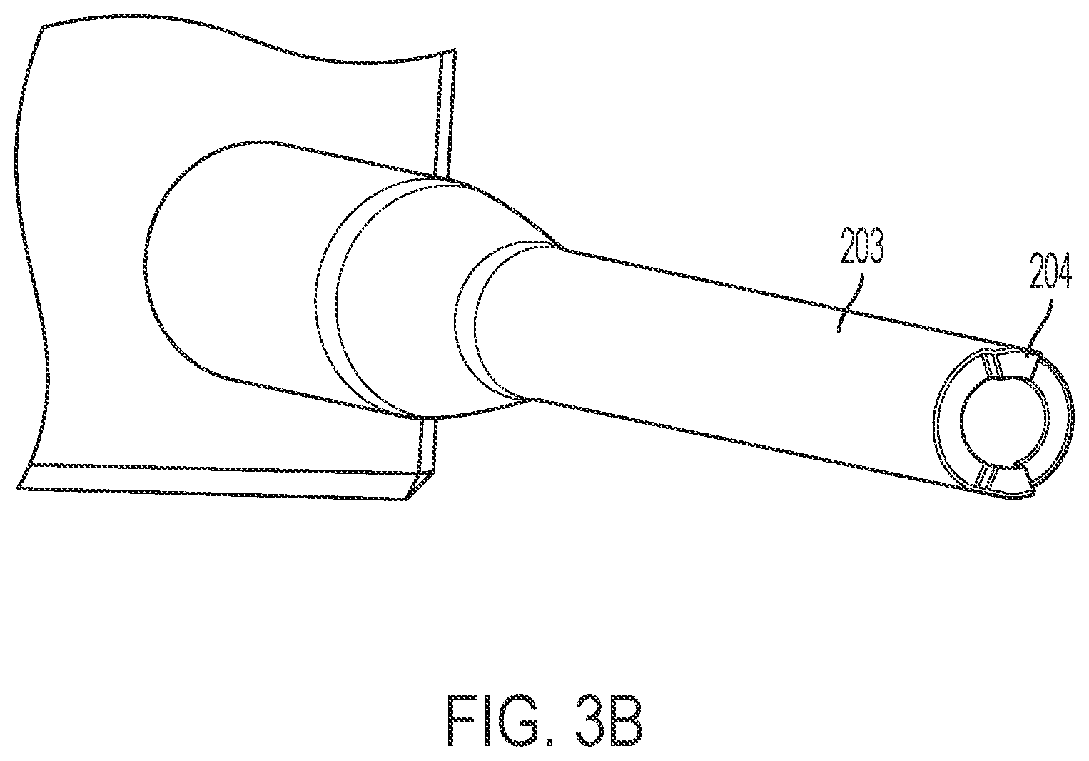 Patent US12102359 Figure 5 – Intramedullary fixation nail and method of use
