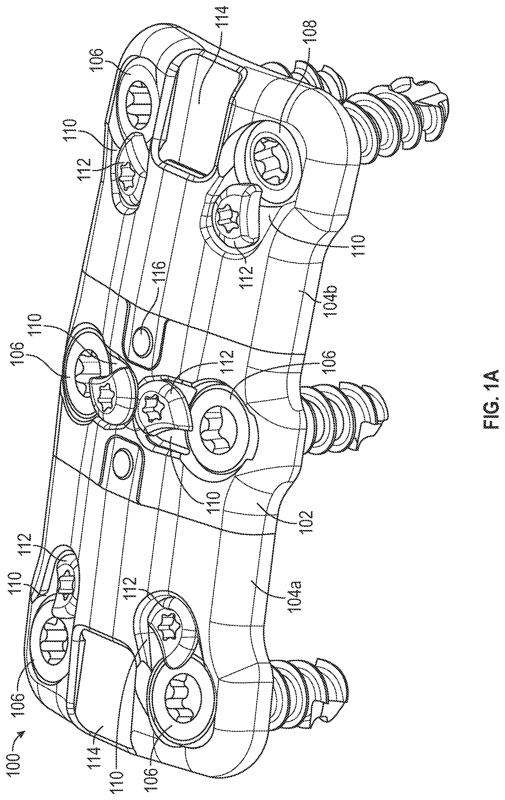 Patent US12102360 Figure 1 – Compressible cervical plate