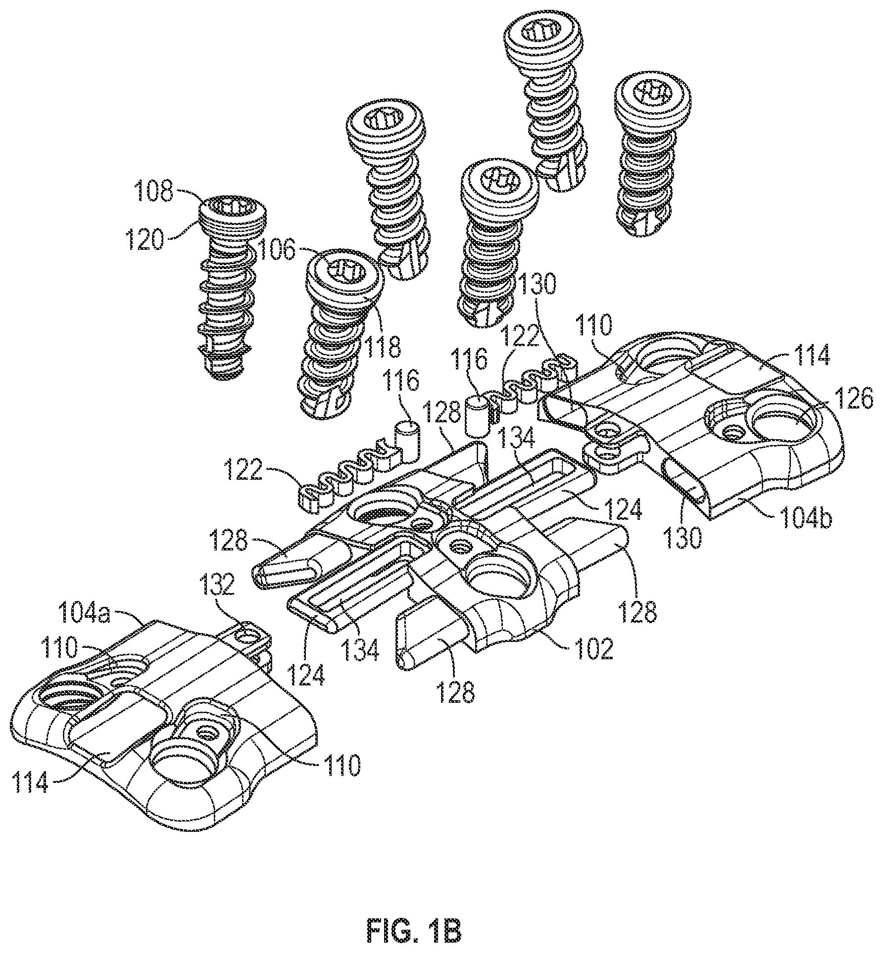 Patent US12102360 Figure 2 – Compressible cervical plate