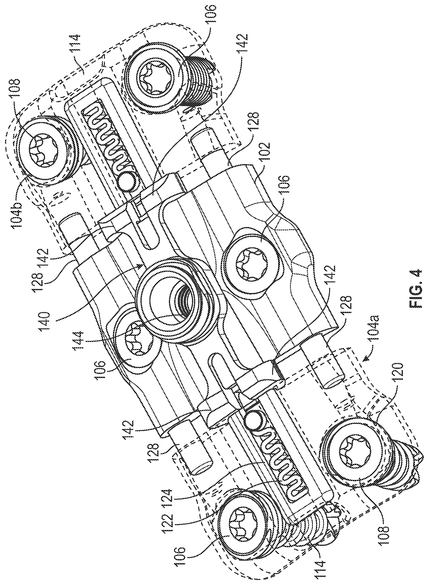 Patent US12102360 Figure 6 – Compressible cervical plate