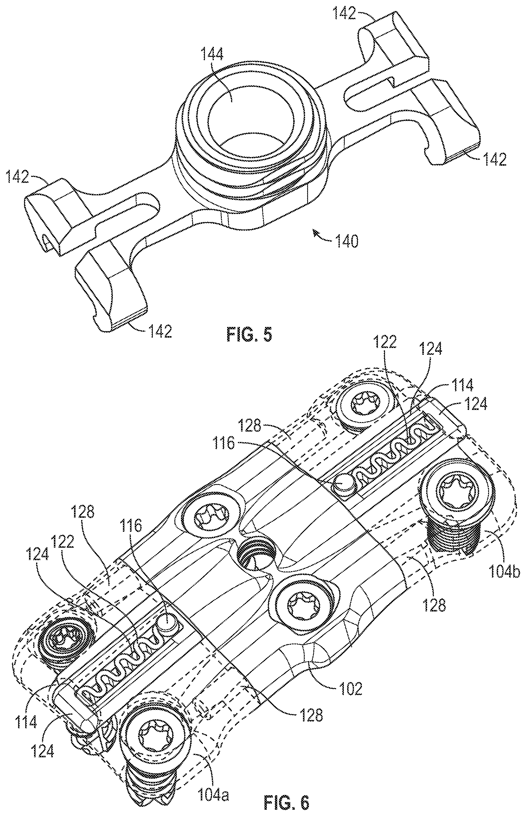 Patent US12102360 Figure 7 – Compressible cervical plate