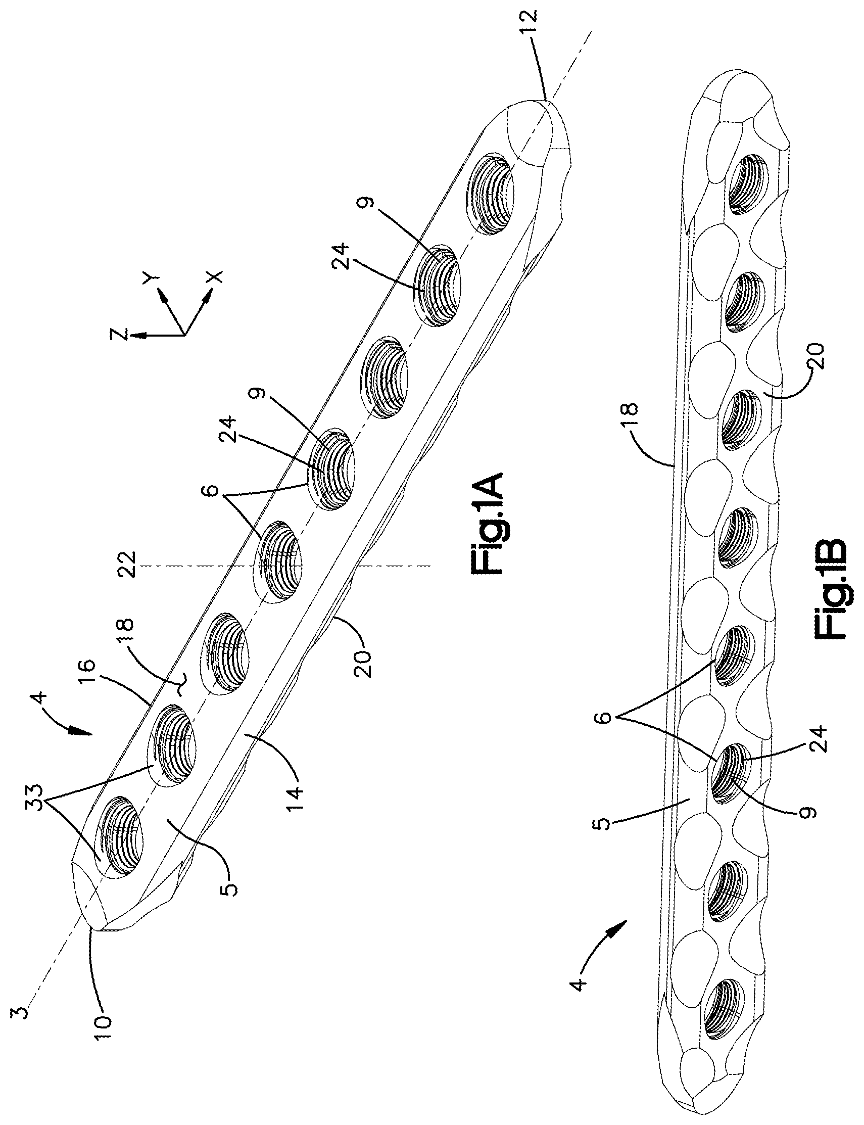 Patent US12102361 Figure 1 – Bone plates having multi-use screw holes for locking and compression screws, and related systems and methods