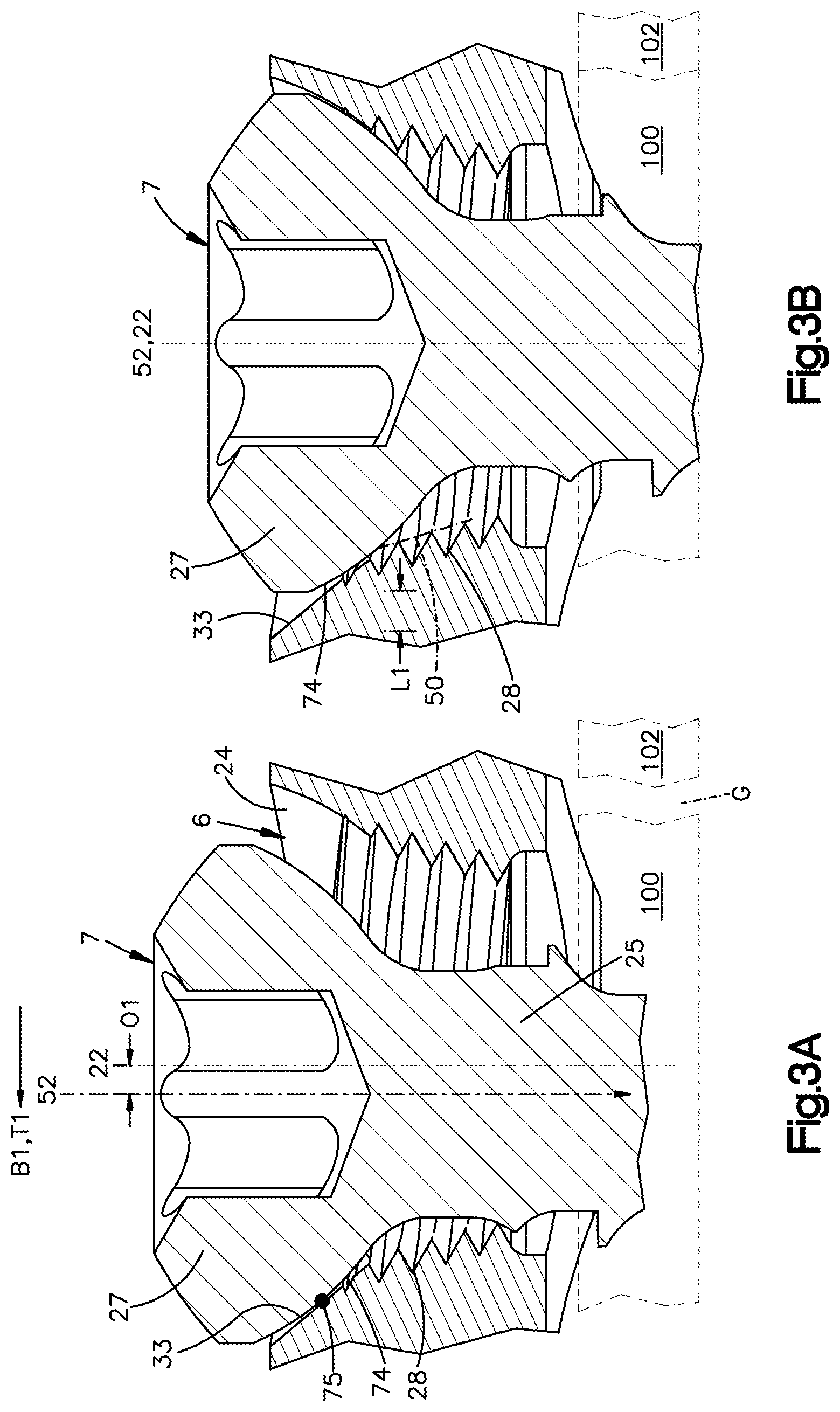 Patent US12102361 Figure 4 – Bone plates having multi-use screw holes for locking and compression screws, and related systems and methods