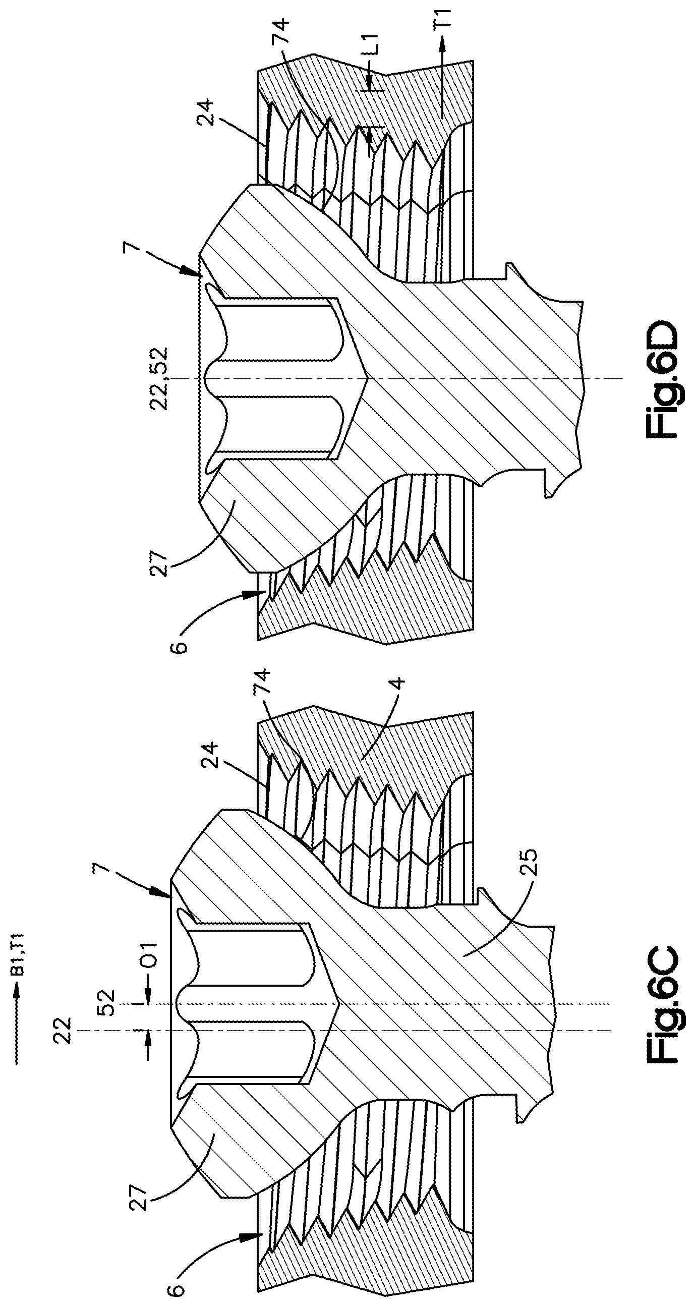 Patent US12102361 Figure 8 – Bone plates having multi-use screw holes for locking and compression screws, and related systems and methods
