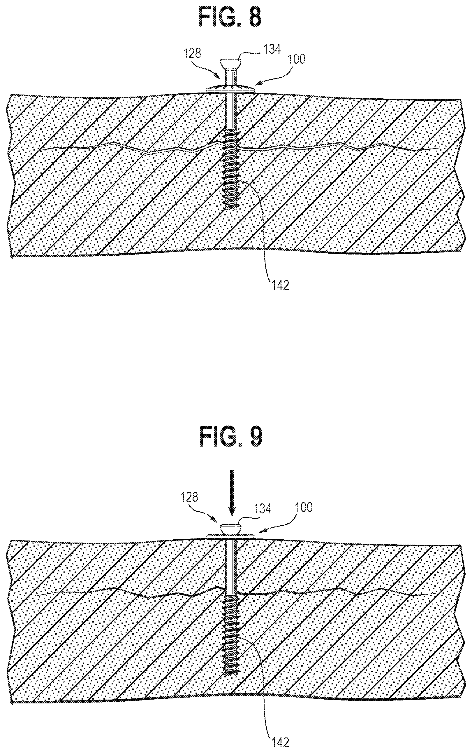 Patent US12102362 Figure 4 – Compression device, kit, and method