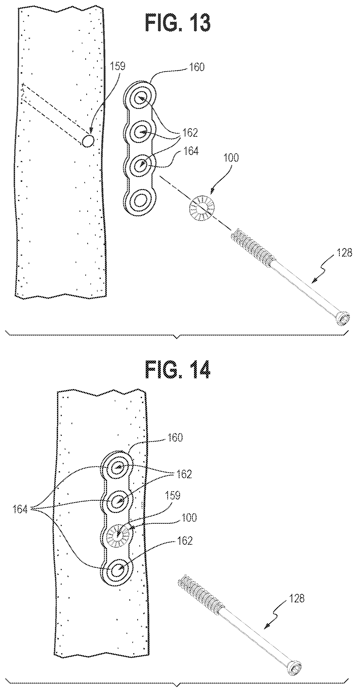 Patent US12102362 Figure 6 – Compression device, kit, and method