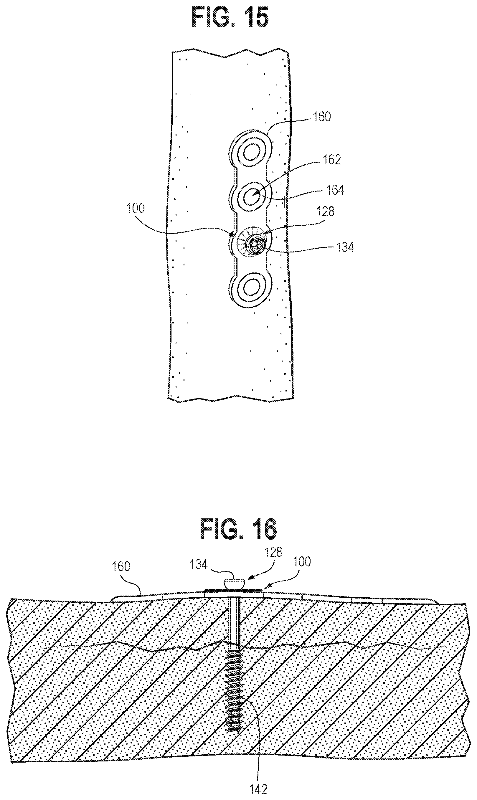 Patent US12102362 Figure 7 – Compression device, kit, and method