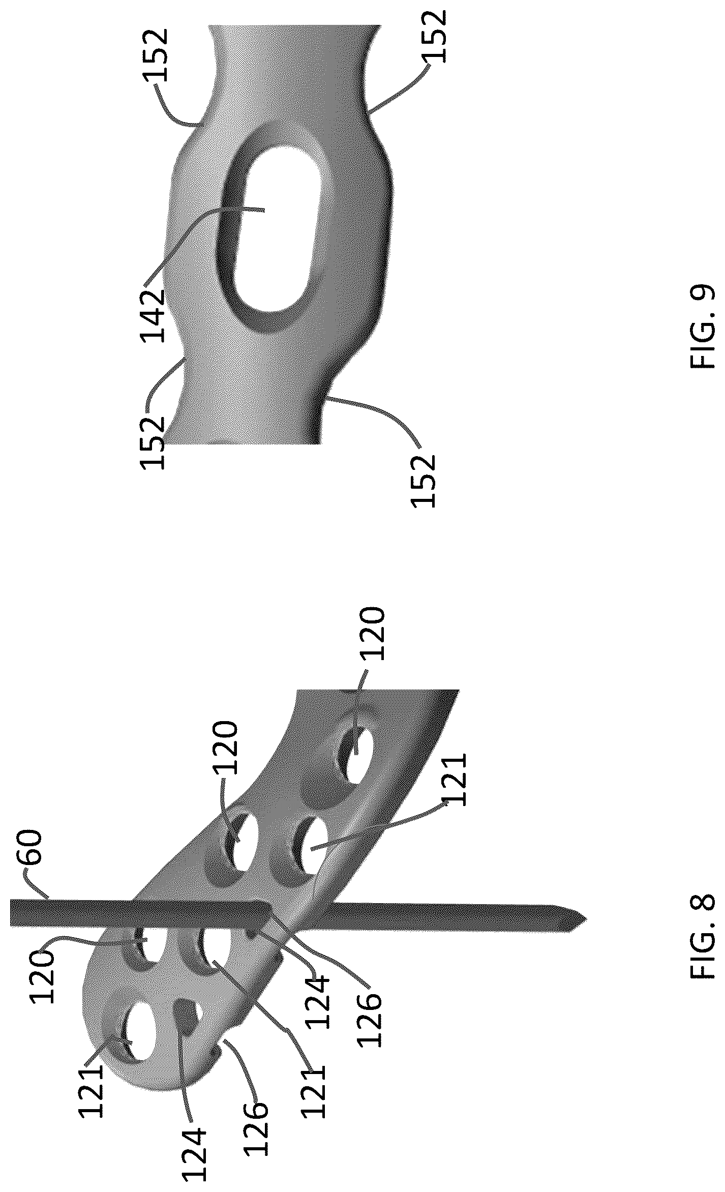 Patent US12102363 Figure 4 – Distal tibial plating system