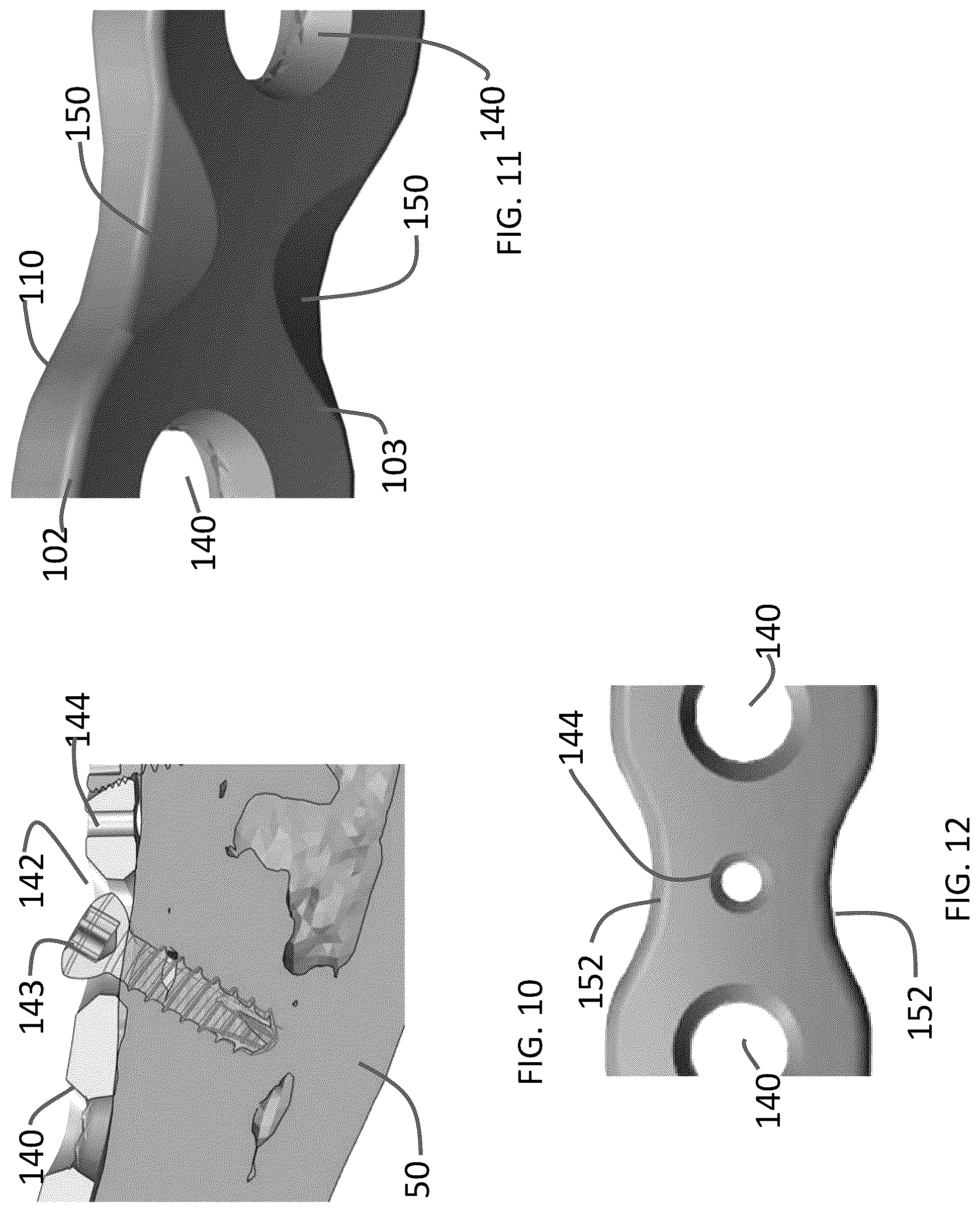 Patent US12102363 Figure 5 – Distal tibial plating system