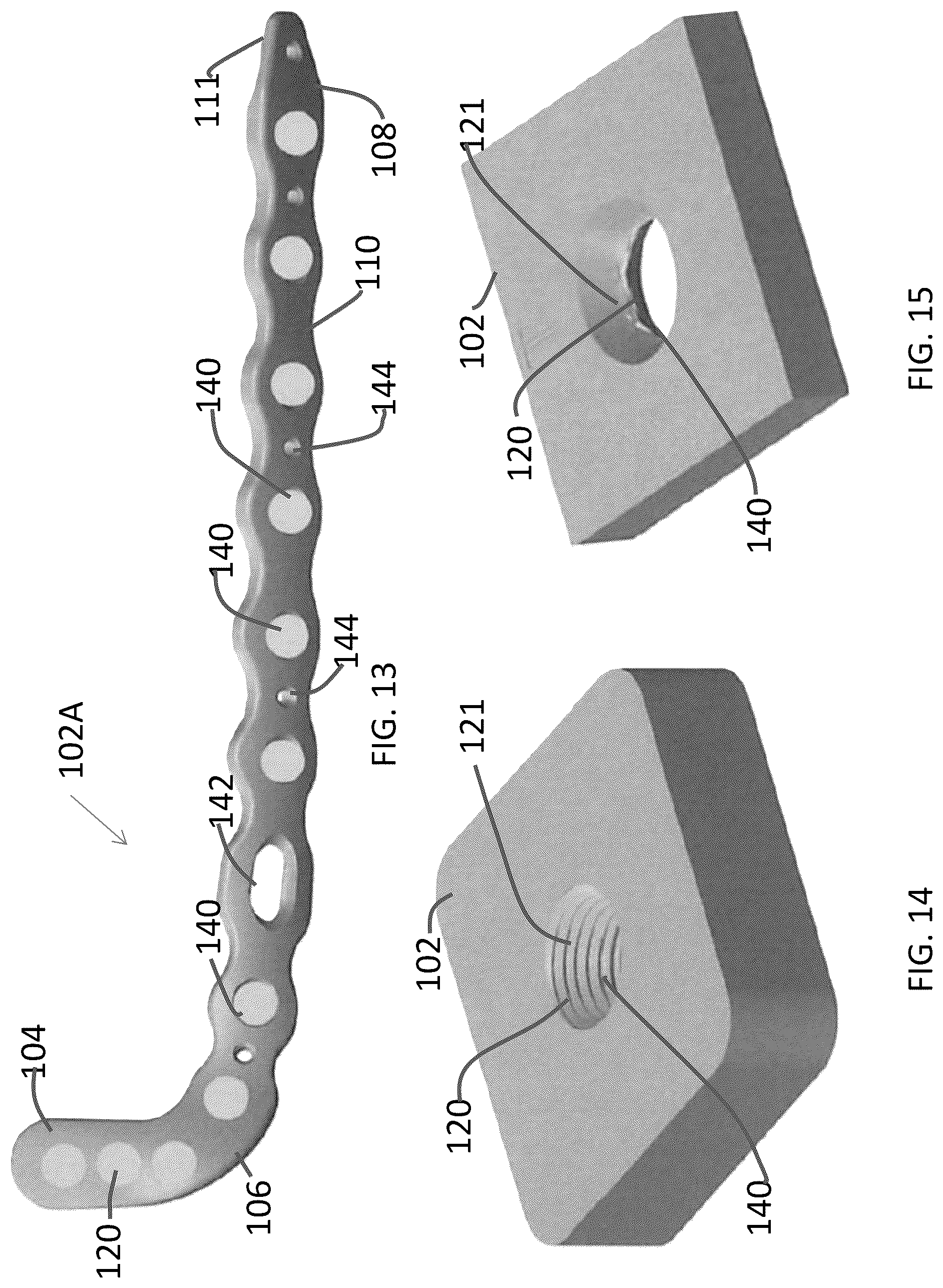 Patent US12102363 Figure 6 – Distal tibial plating system