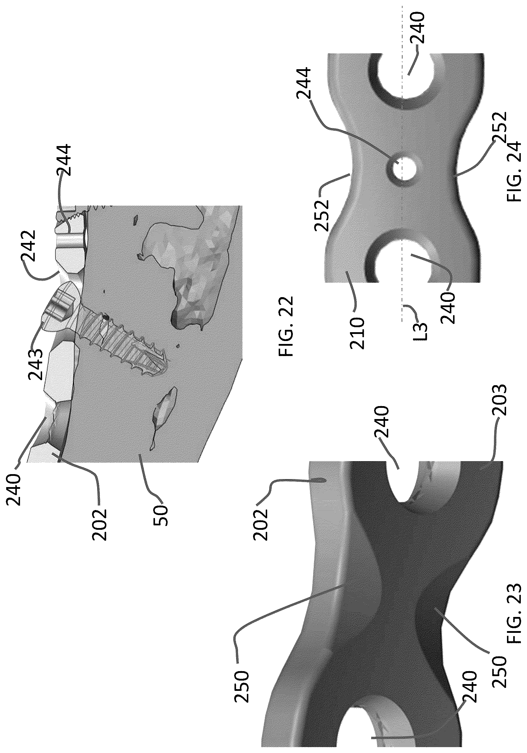 Patent US12102363 Figure 10 – Distal tibial plating system