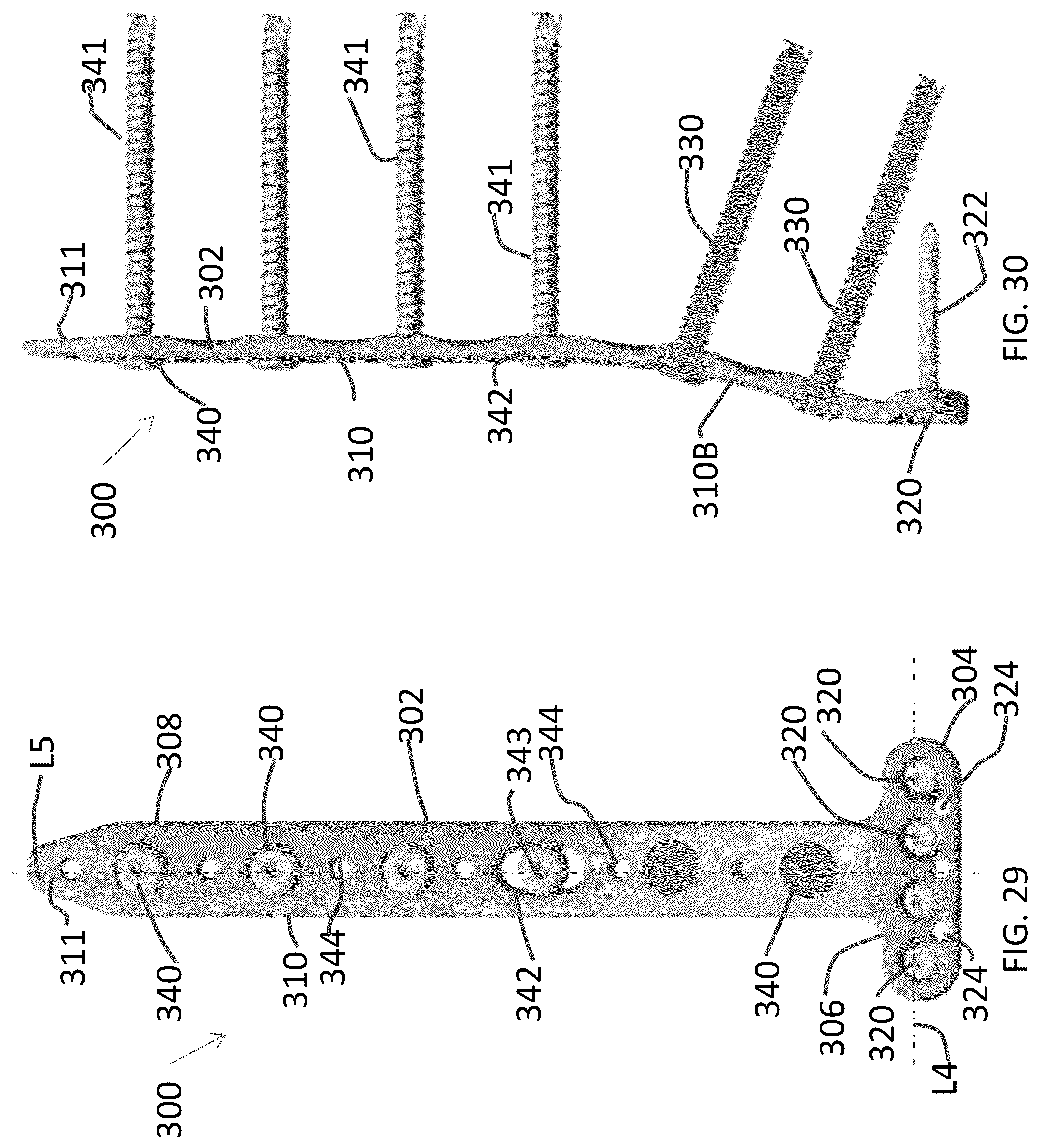Patent US12102363 Figure 13 – Distal tibial plating system