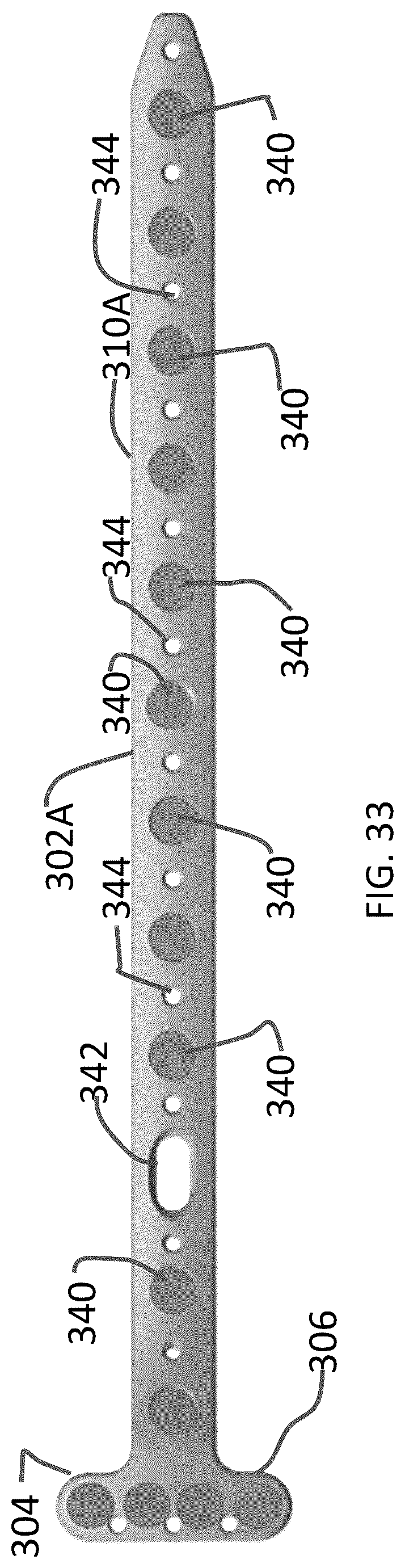 Patent US12102363 Figure 15 – Distal tibial plating system