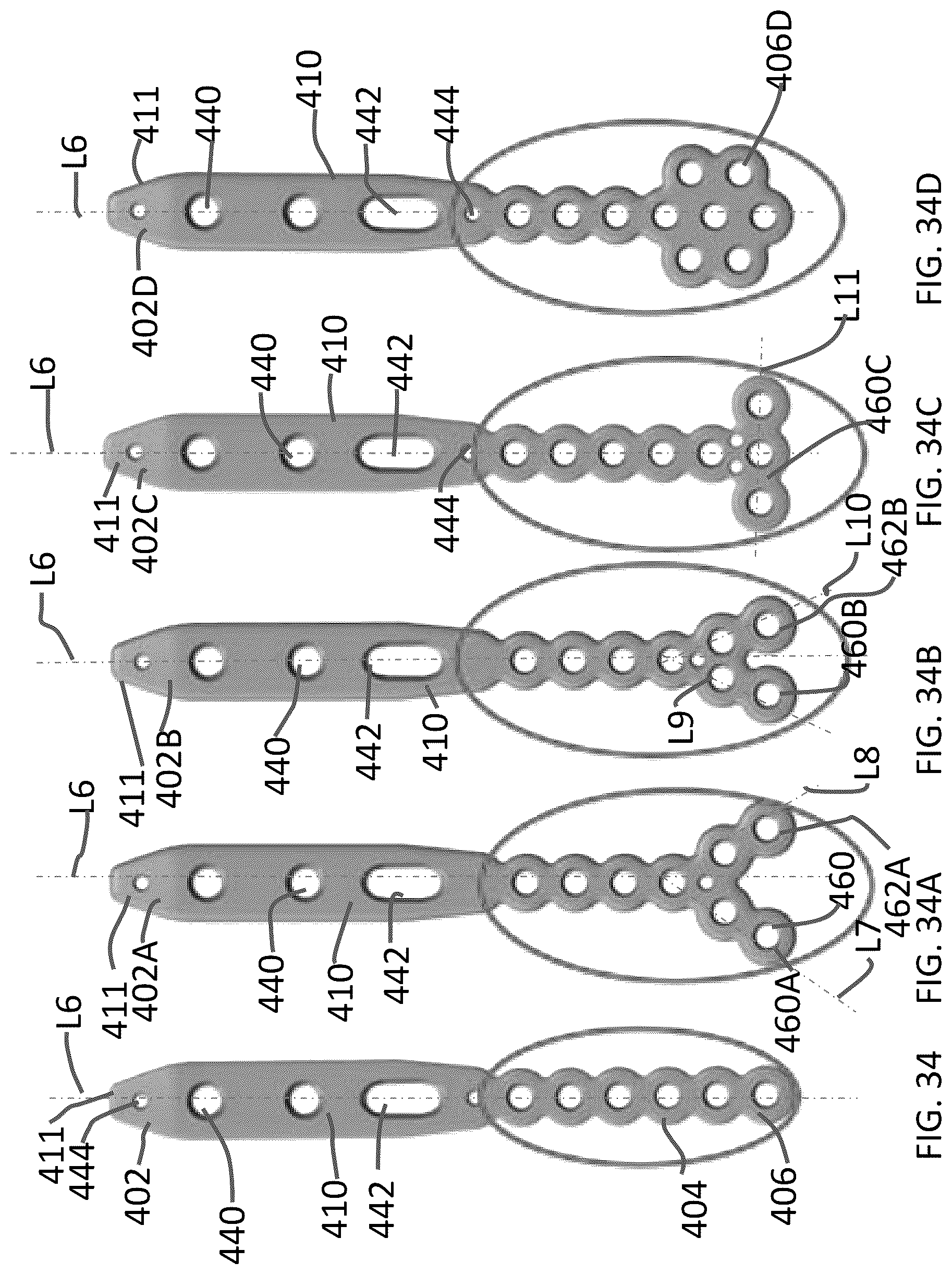 Patent US12102363 Figure 16 – Distal tibial plating system