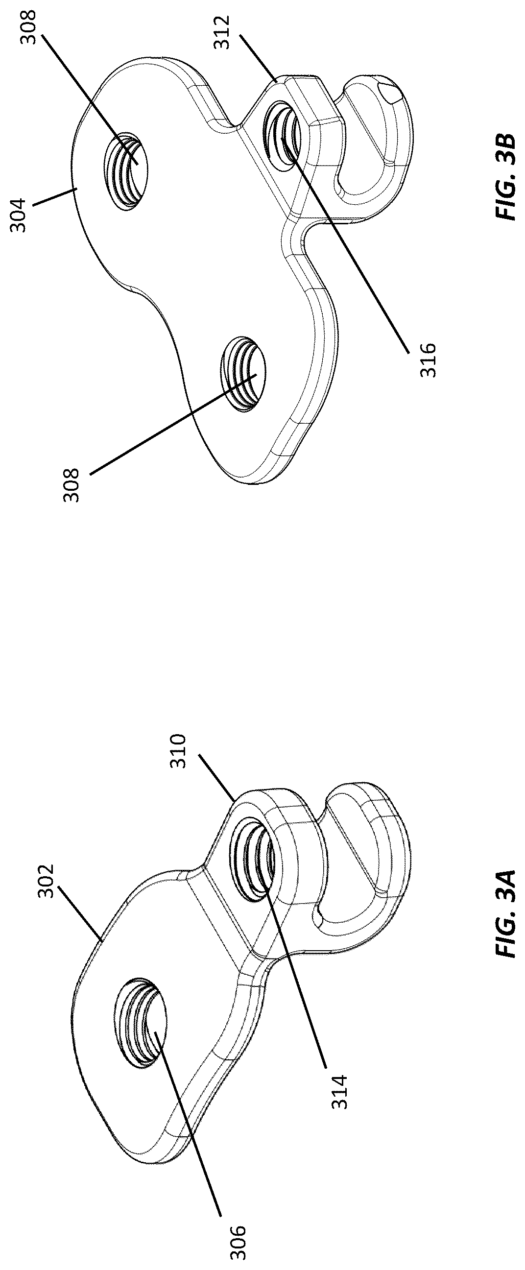 Patent US12102364 Figure 3 – Systems and methods for treating rib fractures and osteotomies using implantation