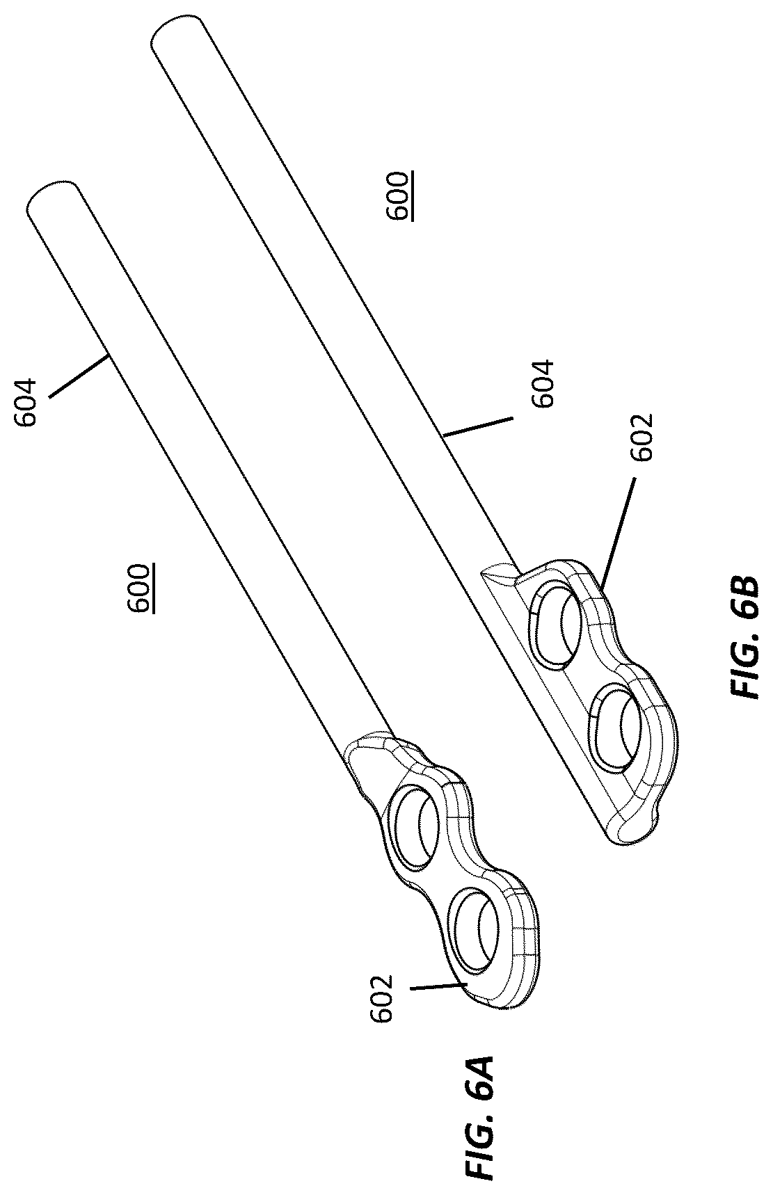 Patent US12102364 Figure 6 – Systems and methods for treating rib fractures and osteotomies using implantation