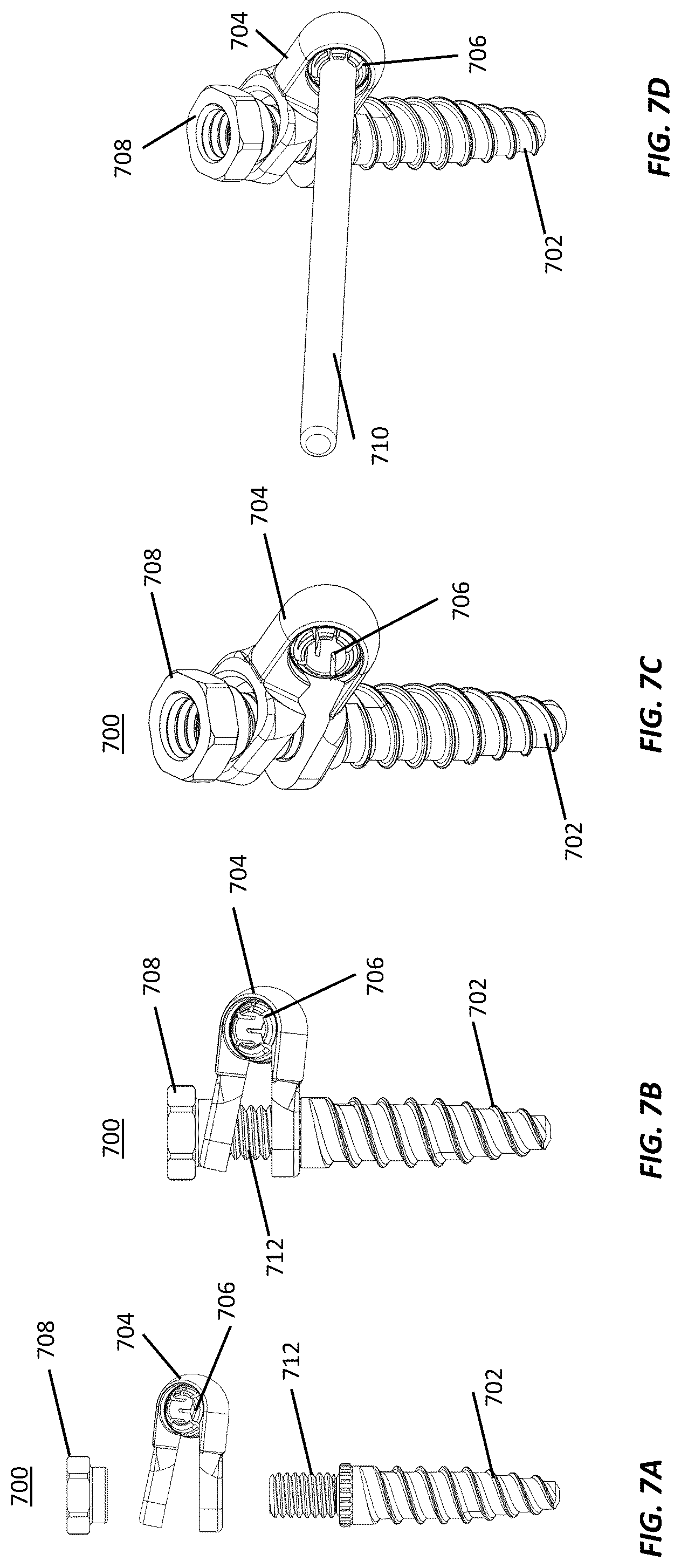 Patent US12102364 Figure 7 – Systems and methods for treating rib fractures and osteotomies using implantation