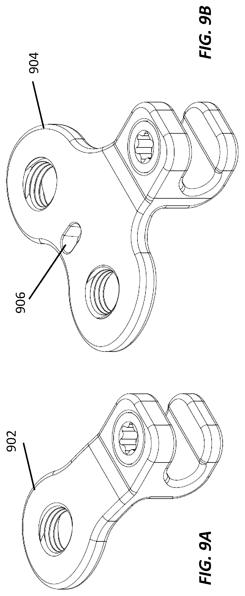 Patent US12102364 Figure 9 – Systems and methods for treating rib fractures and osteotomies using implantation
