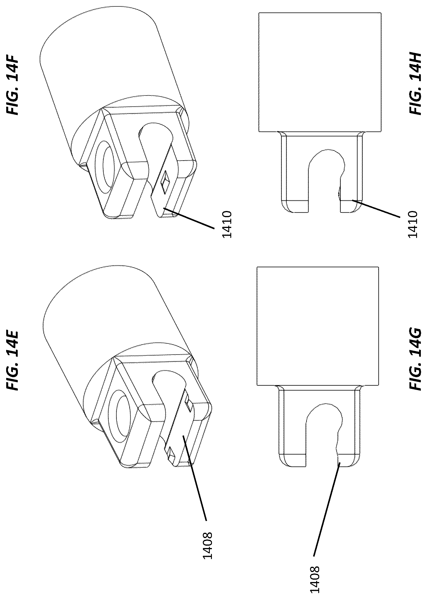 Patent US12102364 Figure 15 – Systems and methods for treating rib fractures and osteotomies using implantation