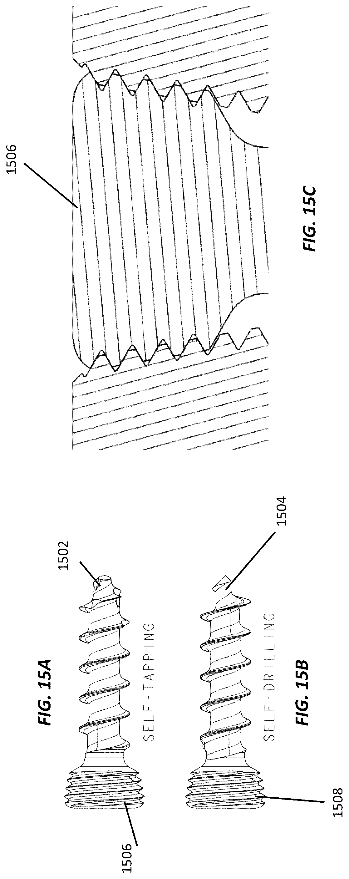 Patent US12102364 Figure 16 – Systems and methods for treating rib fractures and osteotomies using implantation