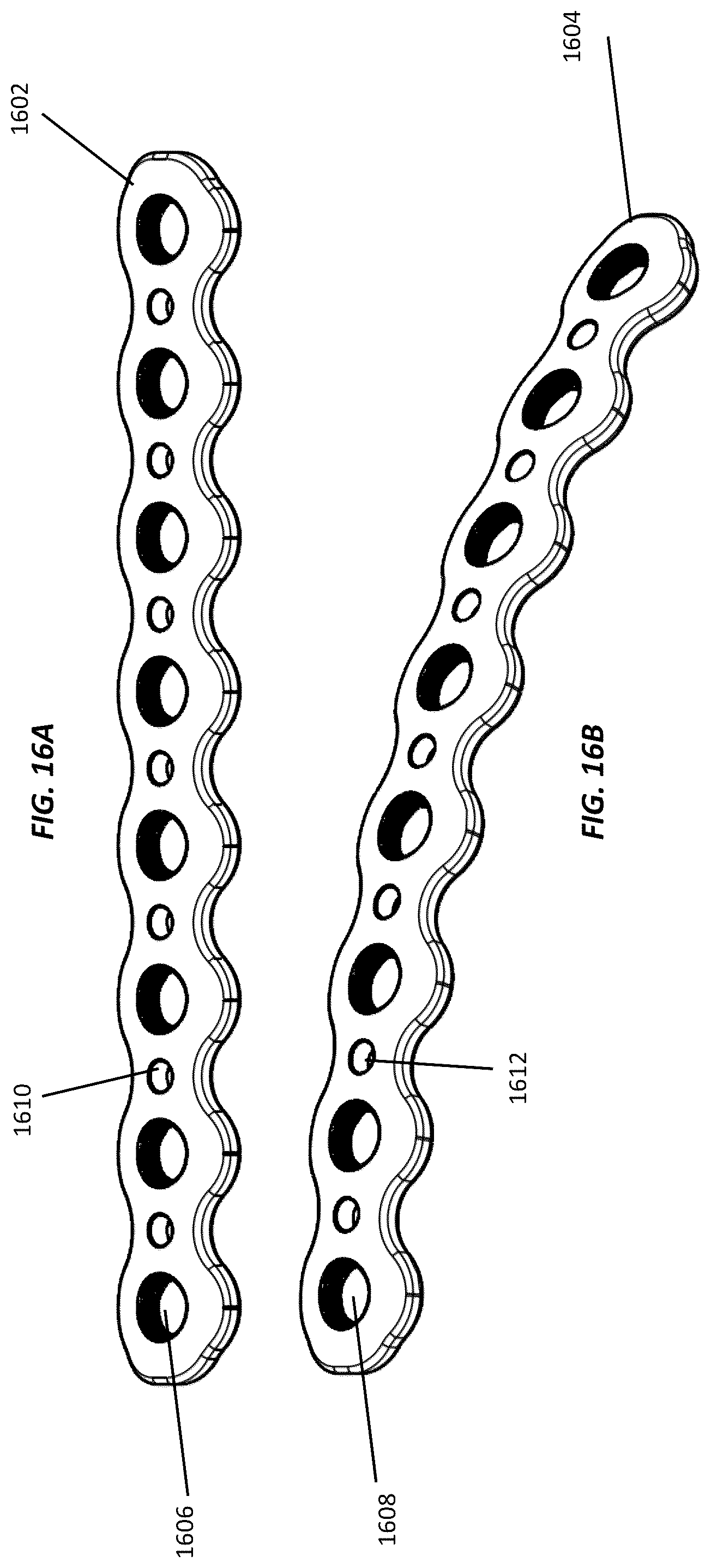Patent US12102364 Figure 17 – Systems and methods for treating rib fractures and osteotomies using implantation