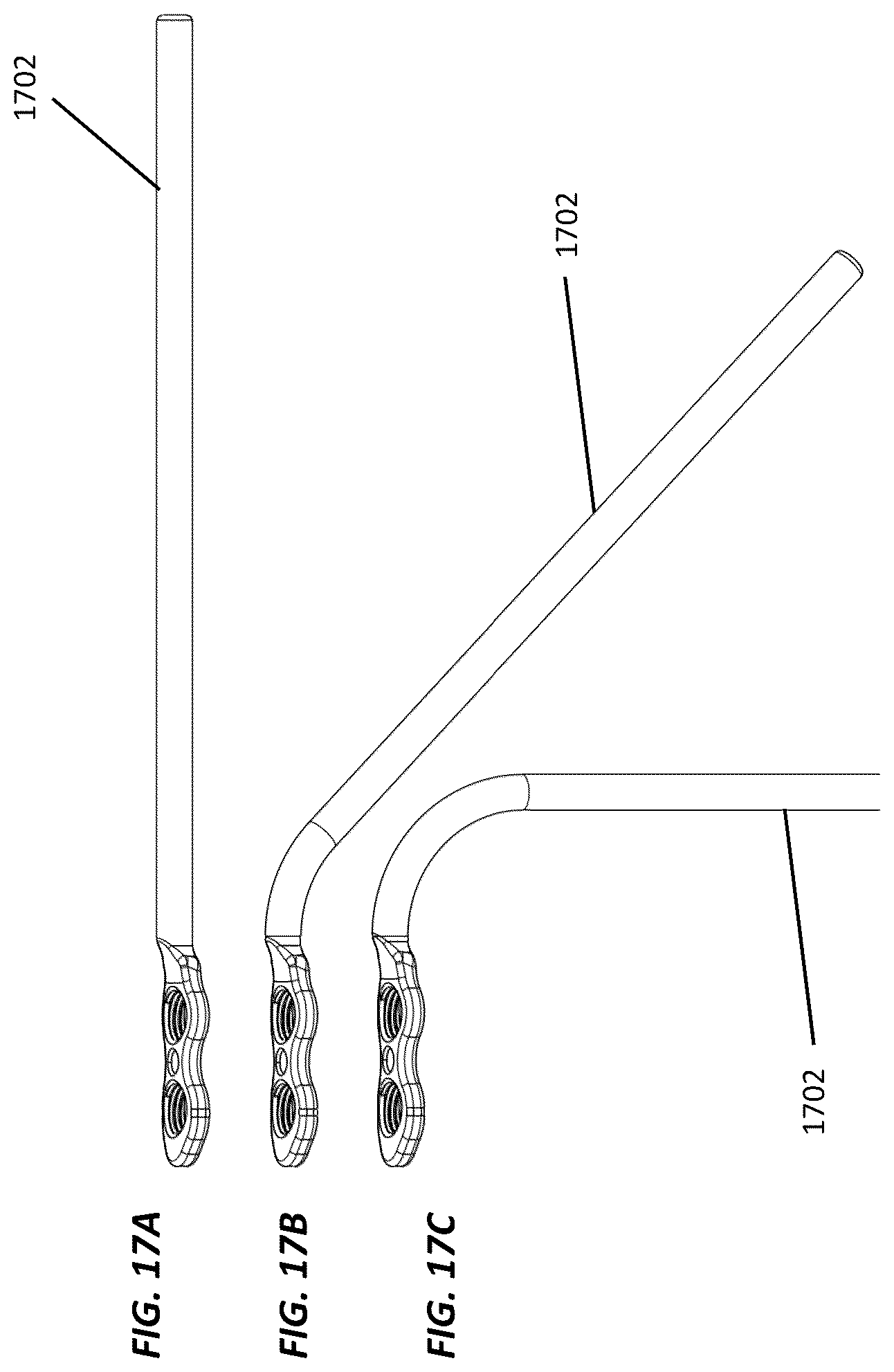 Patent US12102364 Figure 18 – Systems and methods for treating rib fractures and osteotomies using implantation