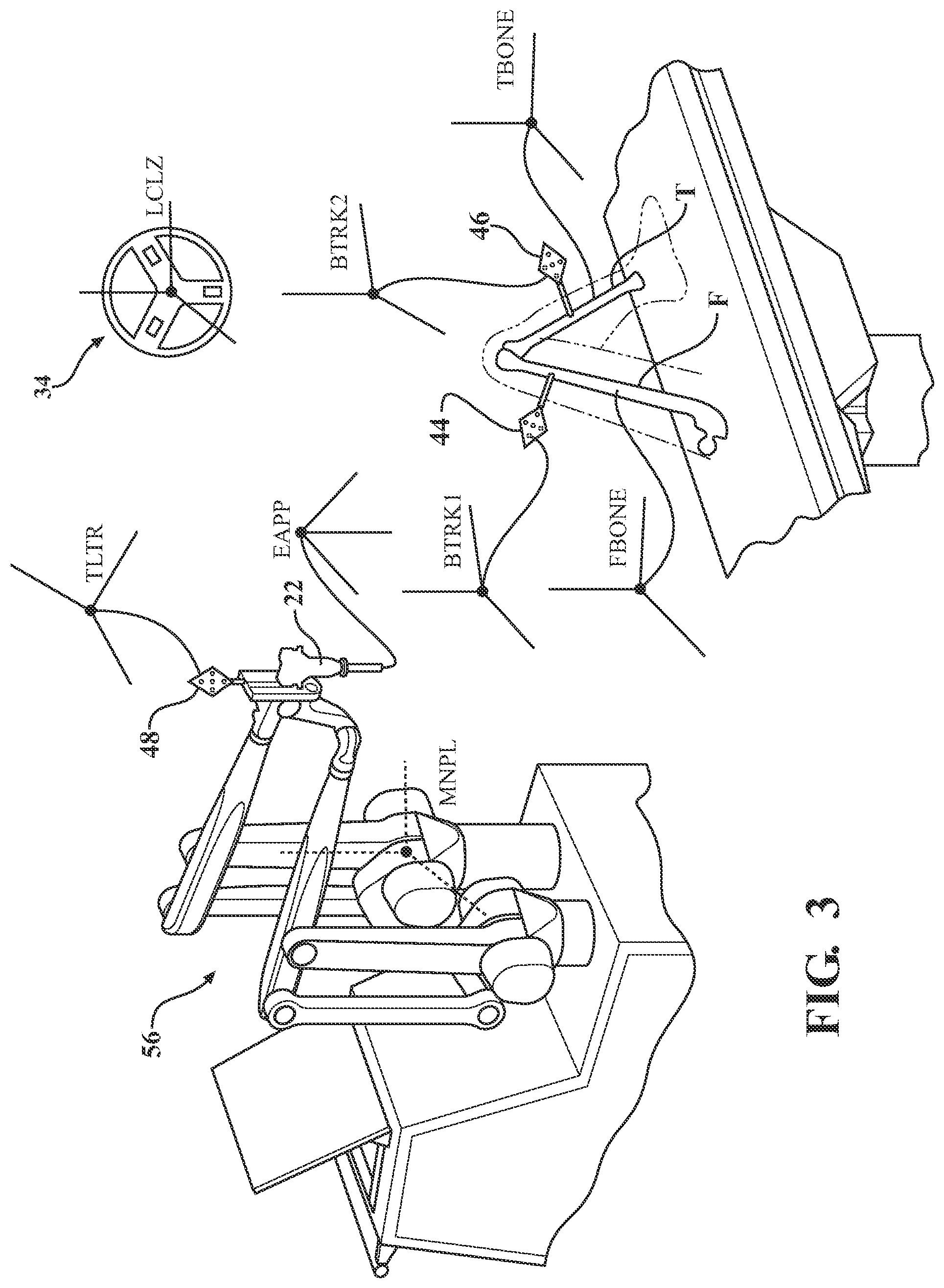 Patent US12102365 Figure 3 – Bone plate for attaching to an anatomic structure